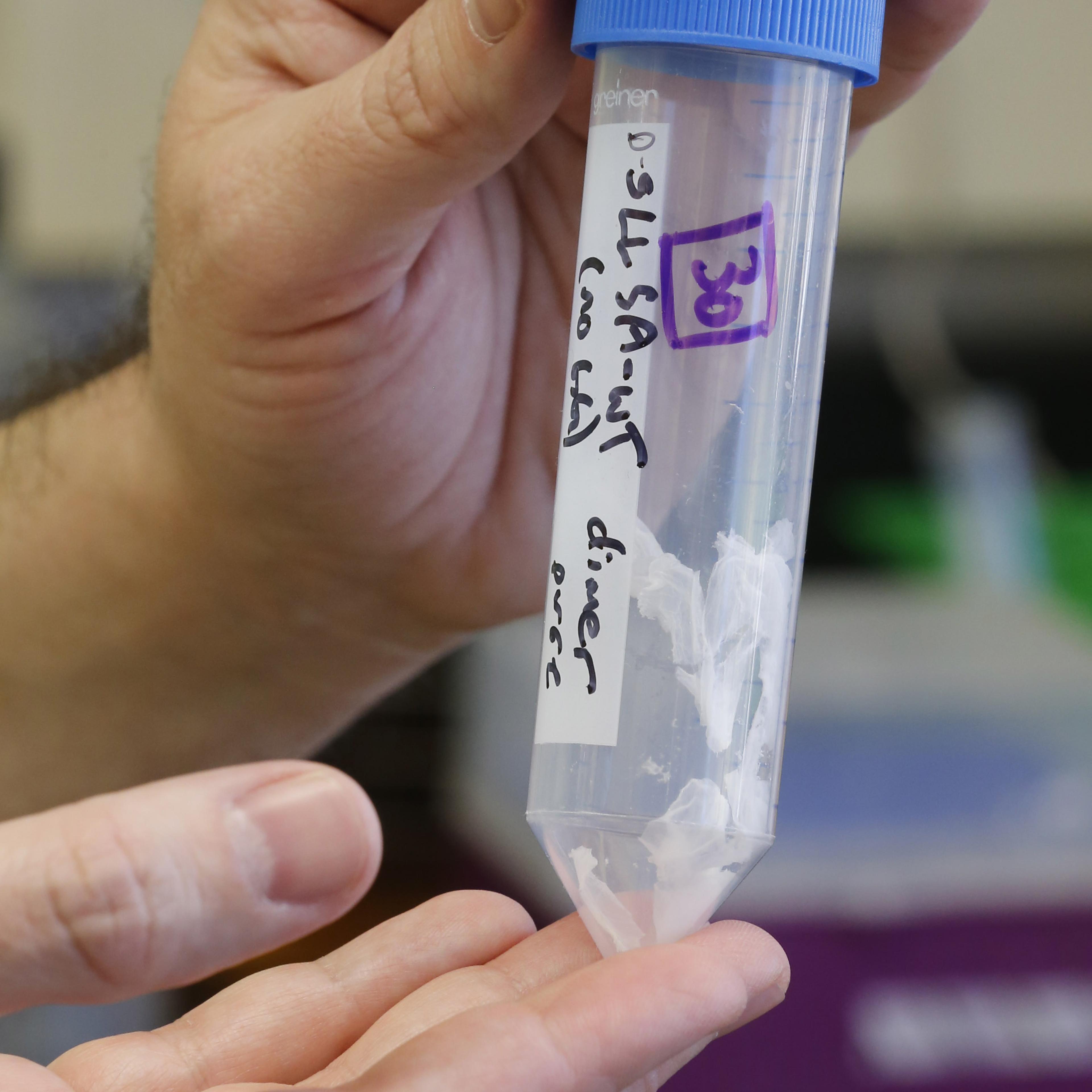 University of Utah Researchers Work Toward Cure For Ebola Strains