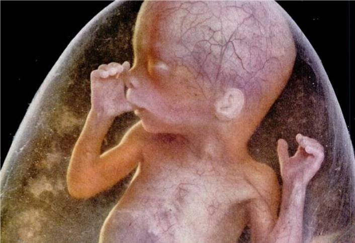 Drama of Life Before Birth