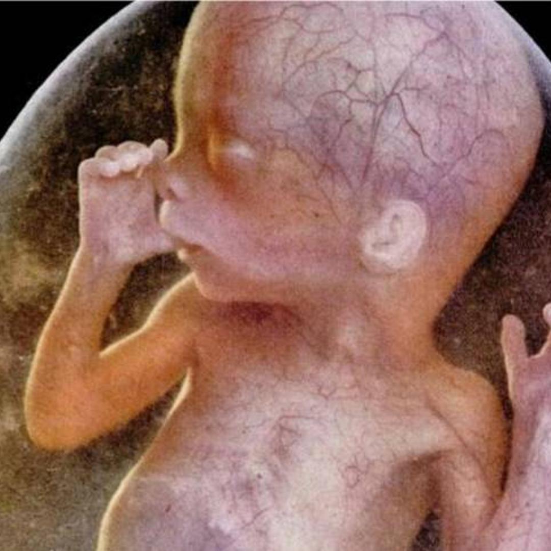 Drama of Life Before Birth