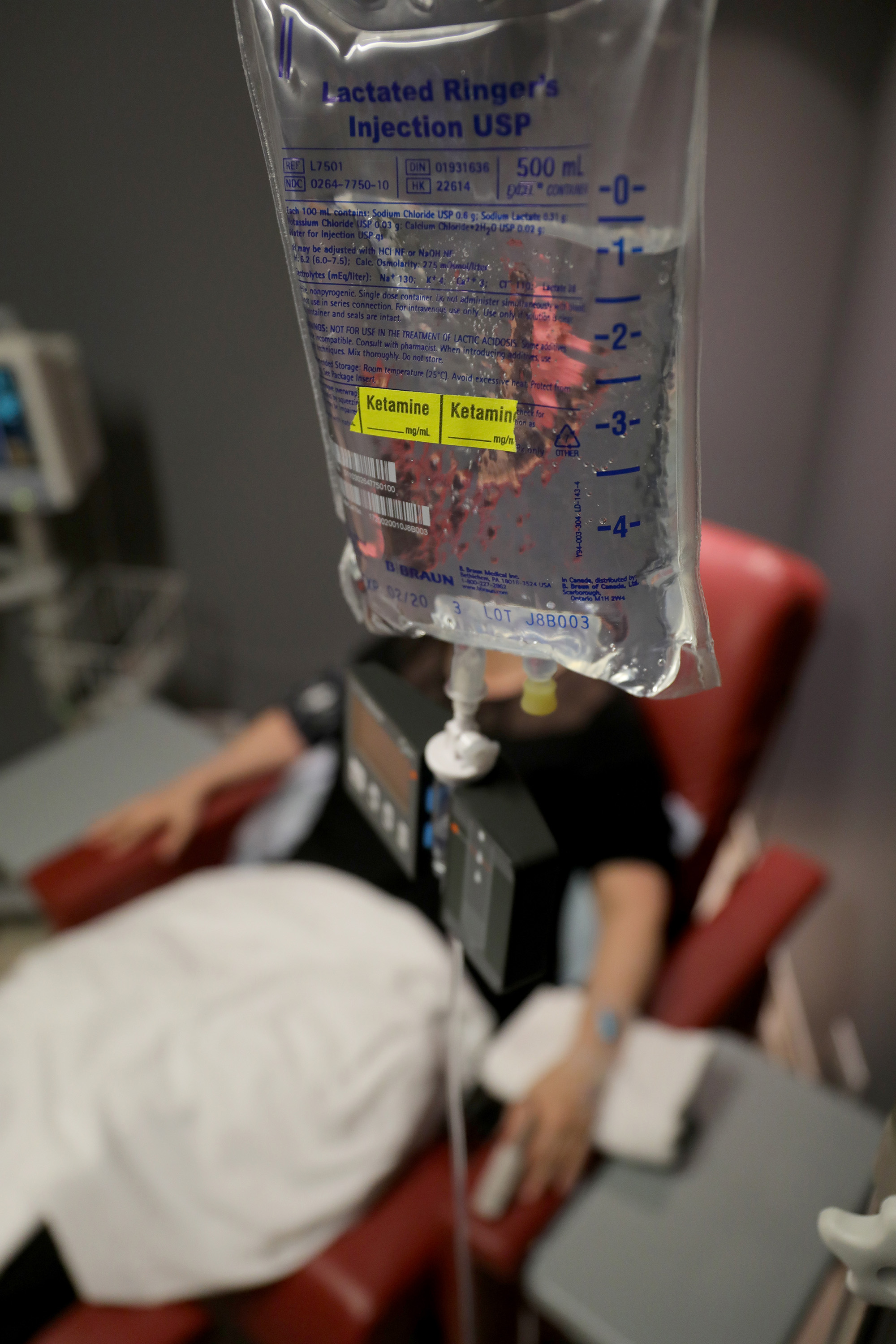 Ketamine, notorious club drug, shows promise as a treatment for depression, studies indicate