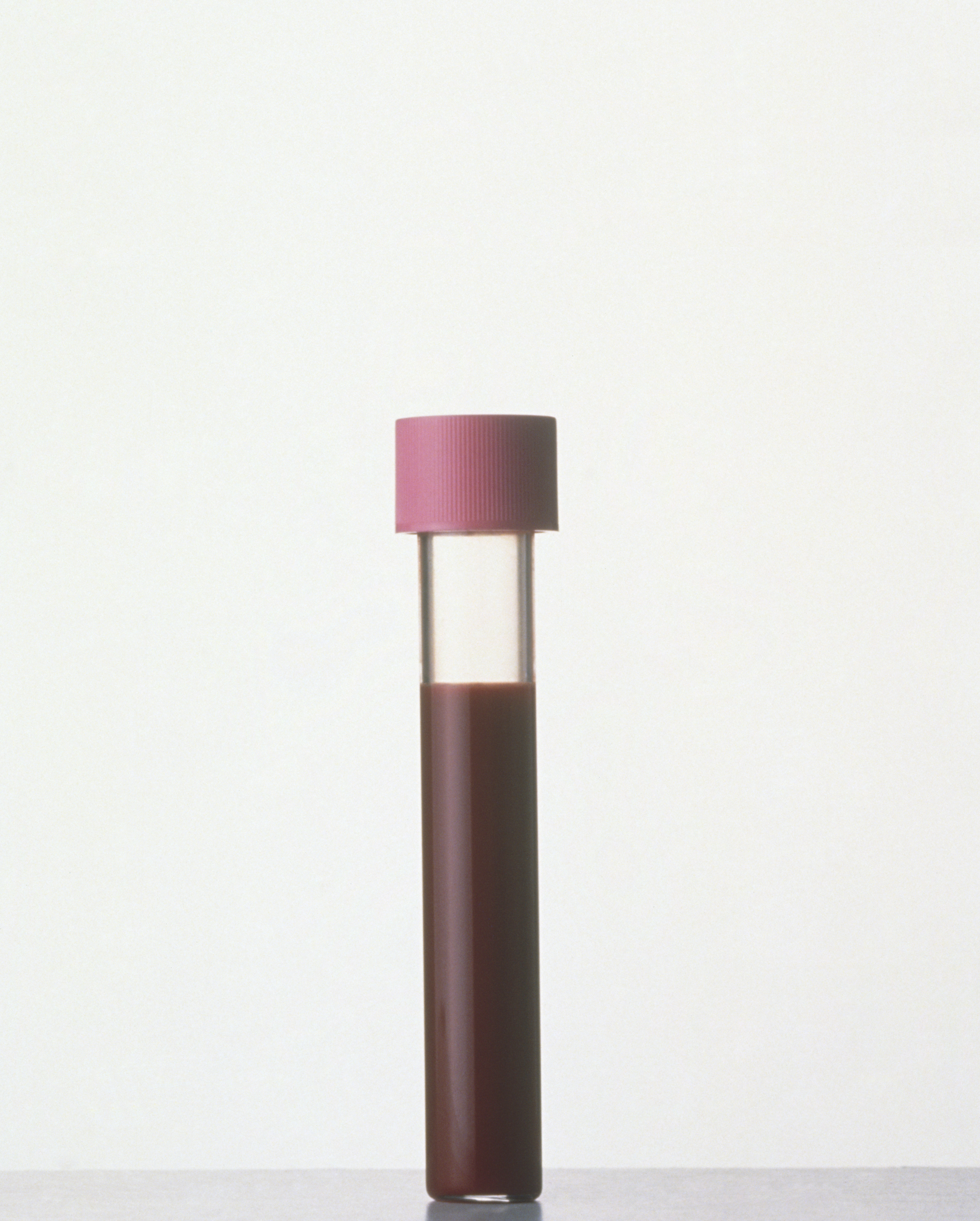 Blood test