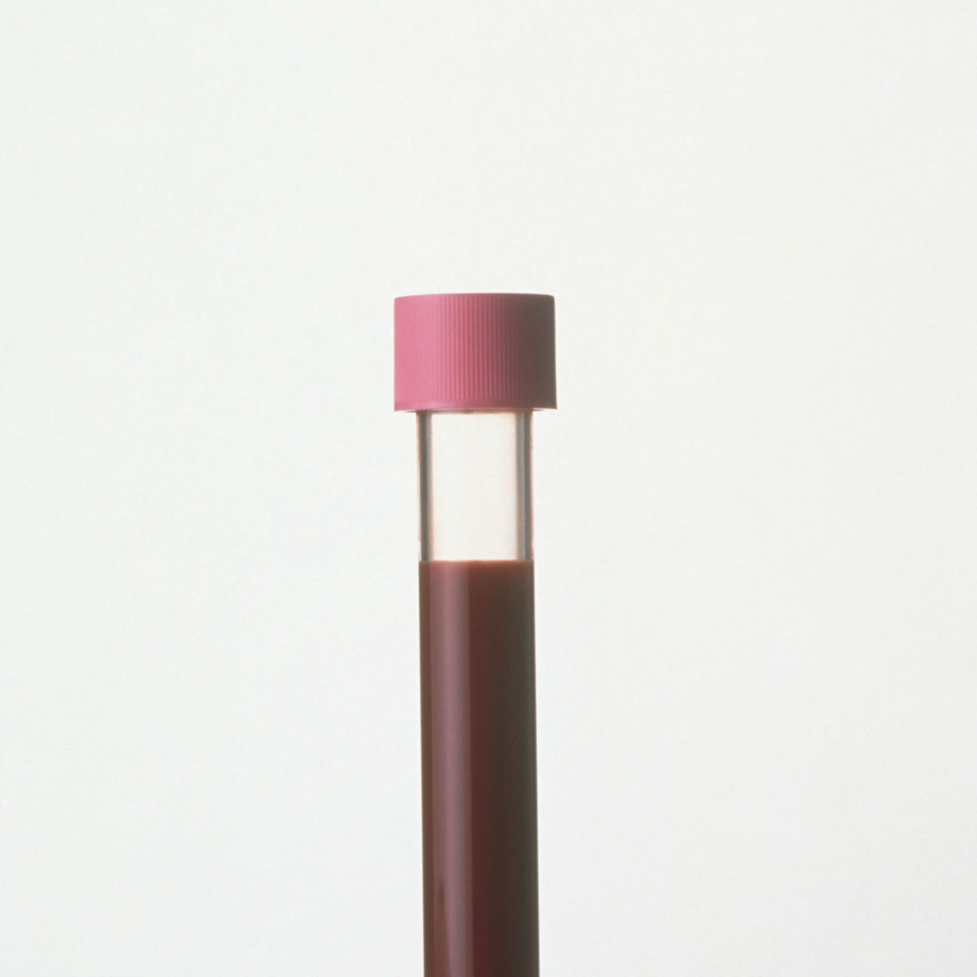 Blood test