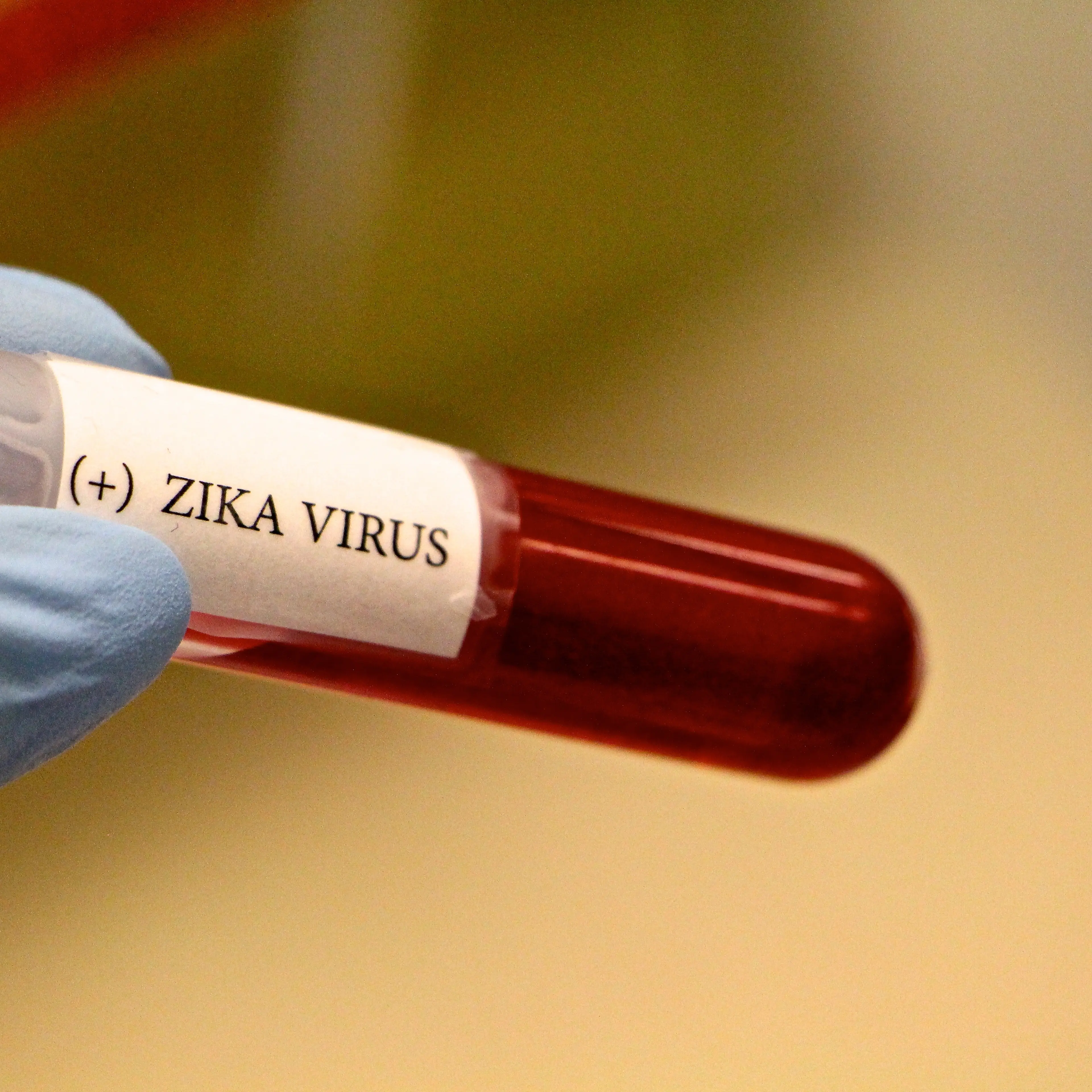 Close-Up Of Hand Holding Blood Sample For Zika Virus Test