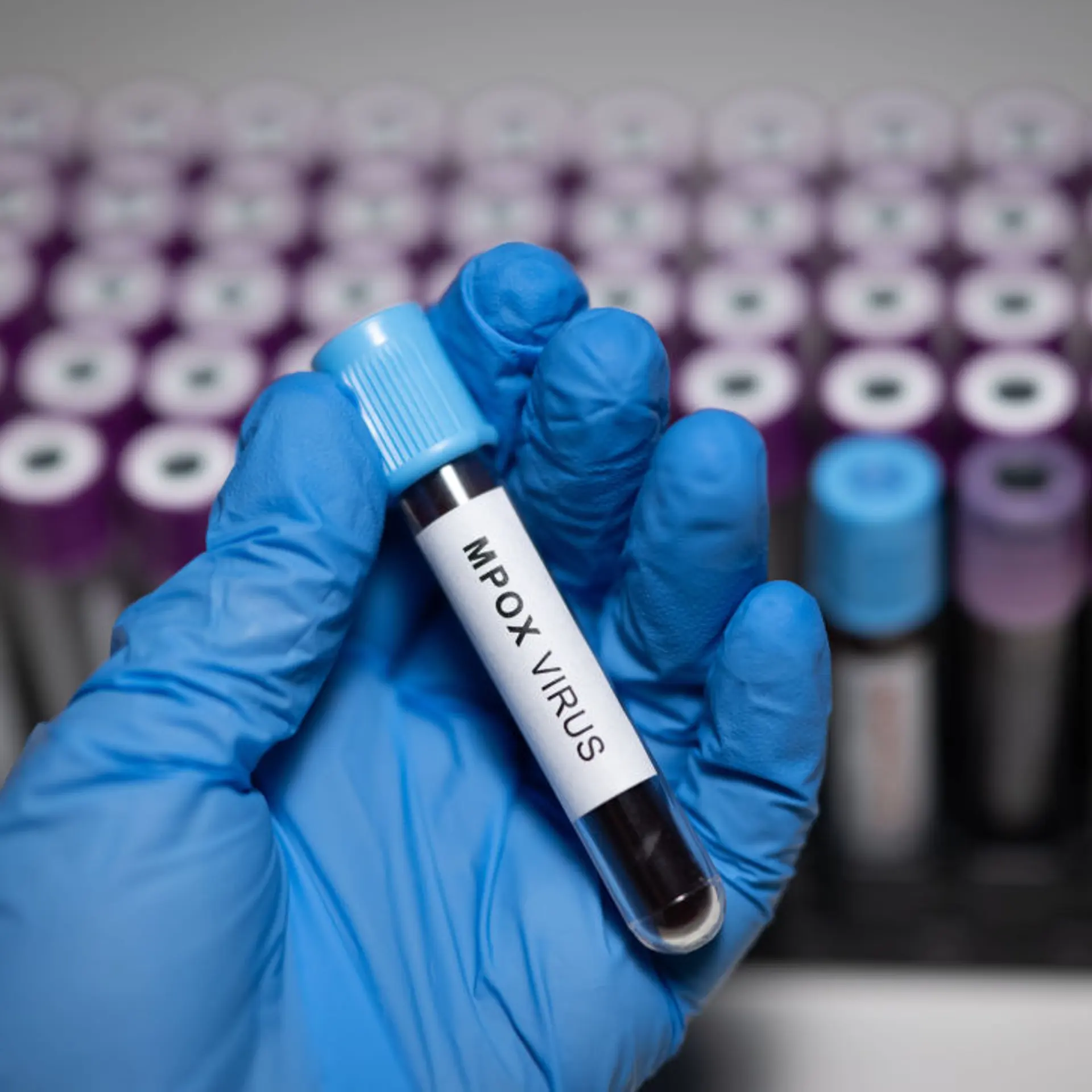 A blue glove holds a test tube of blood marked "mpox virus" in front of several other test tubes.