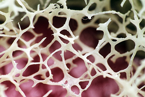 A Court Allows Payment for Bone Marrow. Should People Be Able to Sell ...