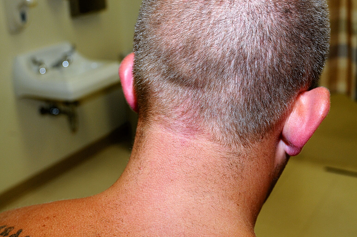 An undated evidence photograph made available by the St. Louis County prosecutors office on Nov. 25, 2014 shows Ferguson police officer Darren Wilson during his medical examination after the shooting of Michael Brown.