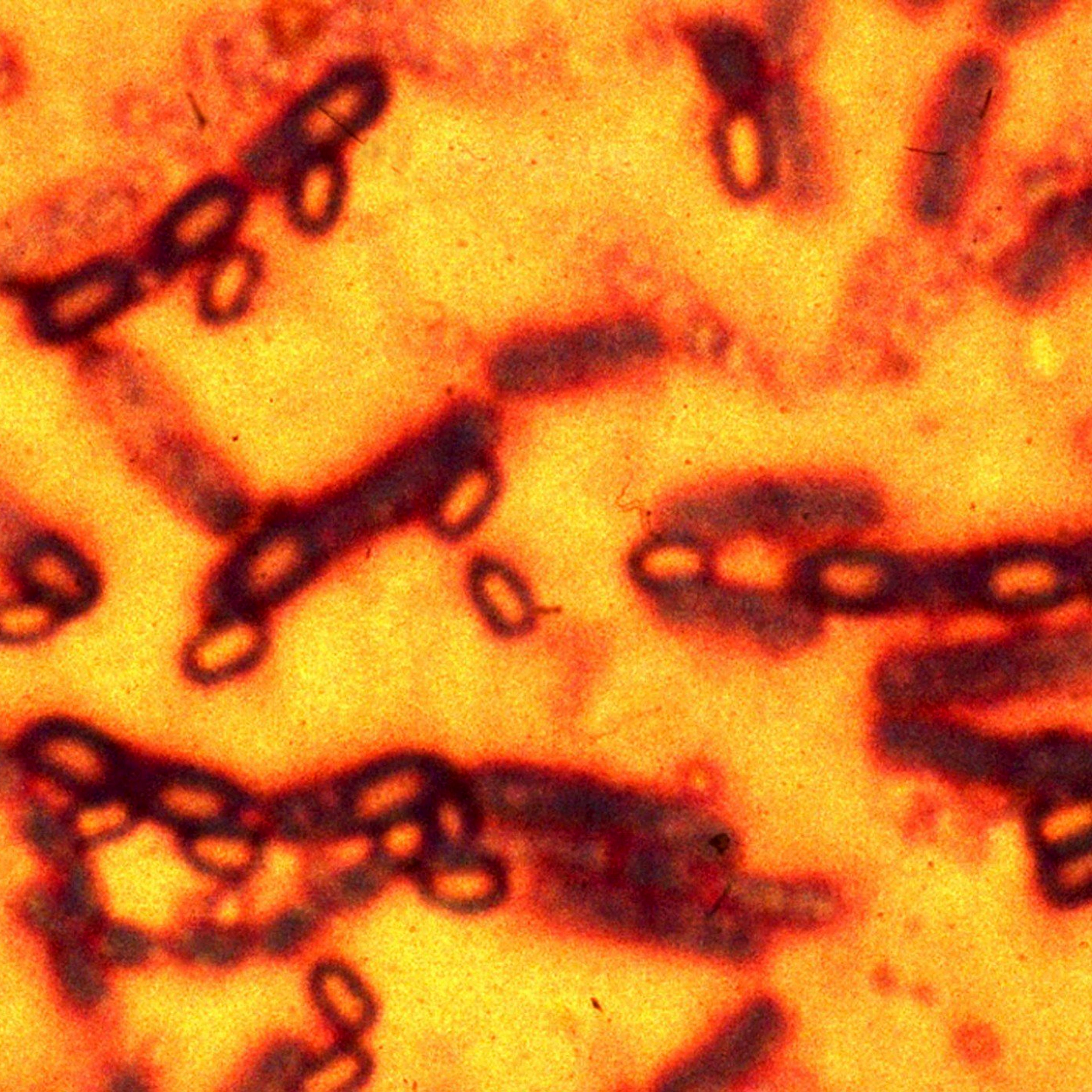 A microscopic picture of spores and vegetative cells of Bacillus anthracis which causes the disease anthrax.