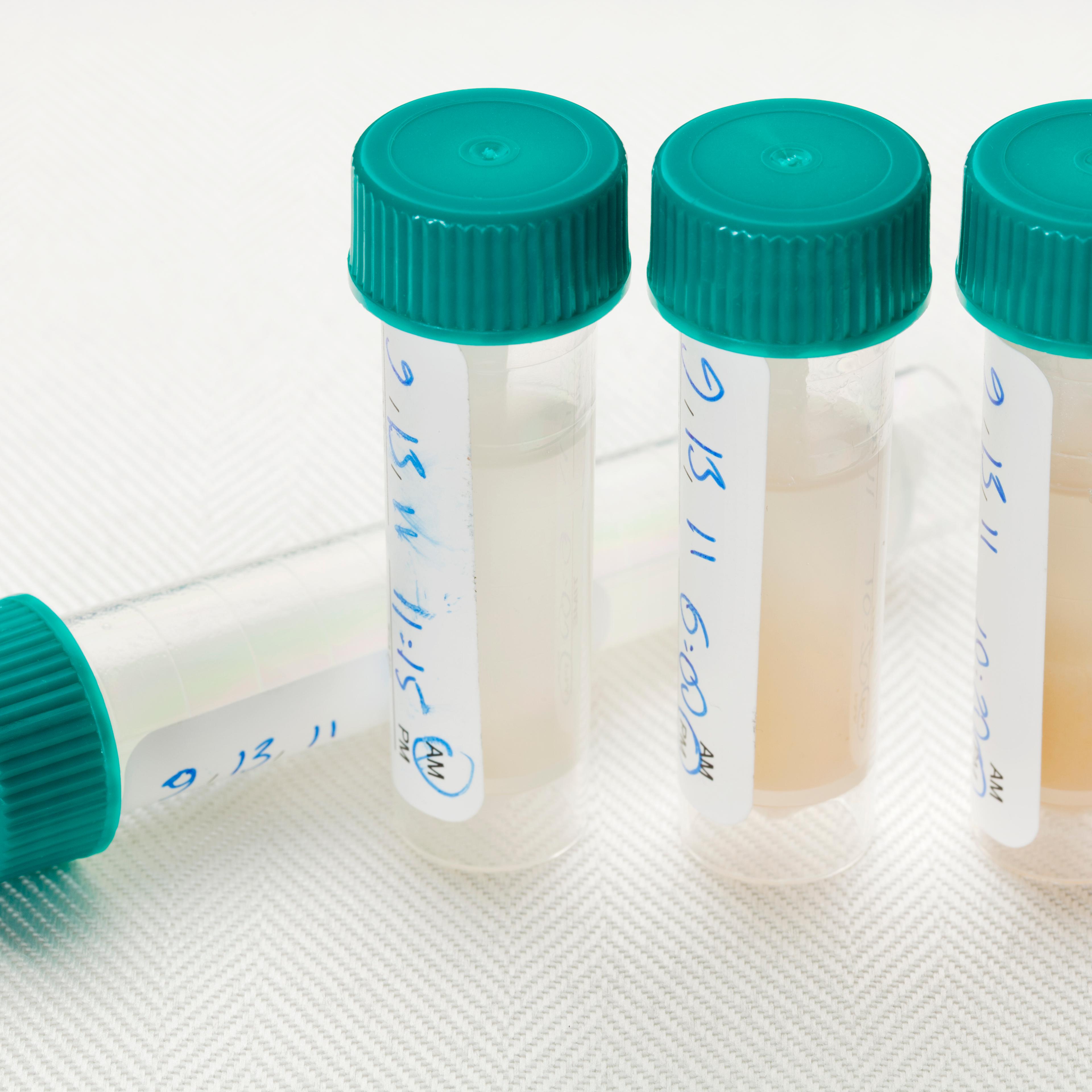 Saliva samples for laboratory test