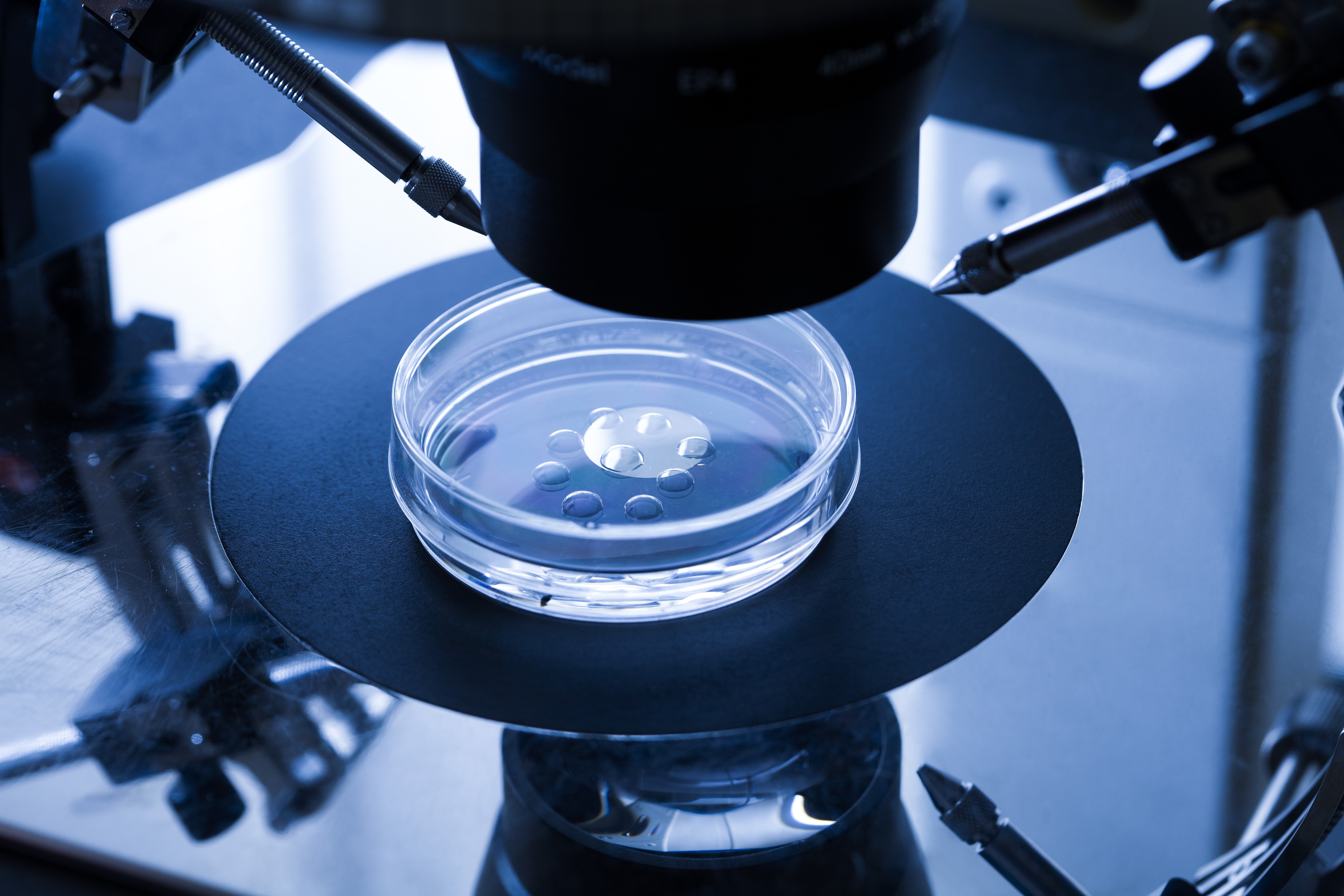 IVF treatment