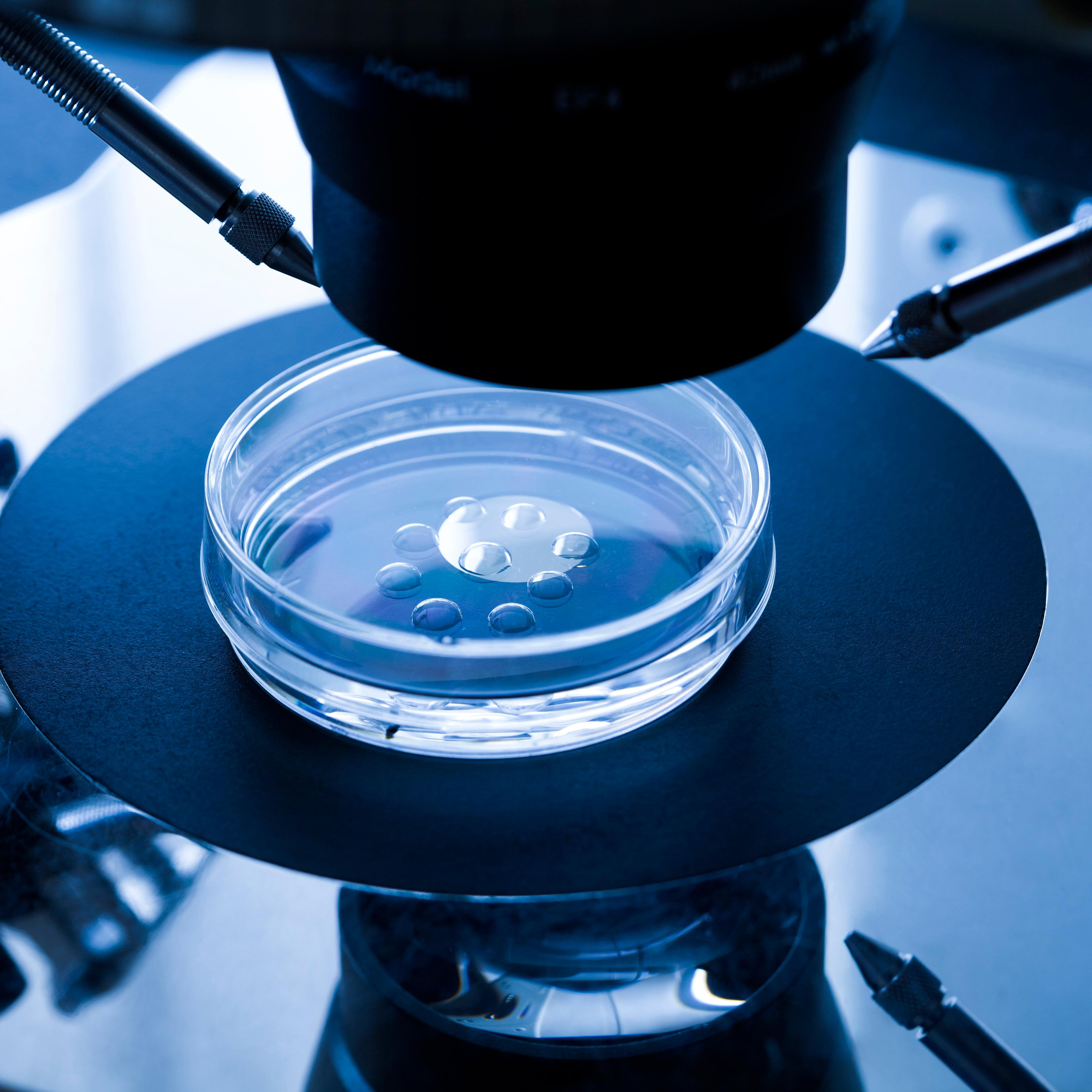 IVF treatment