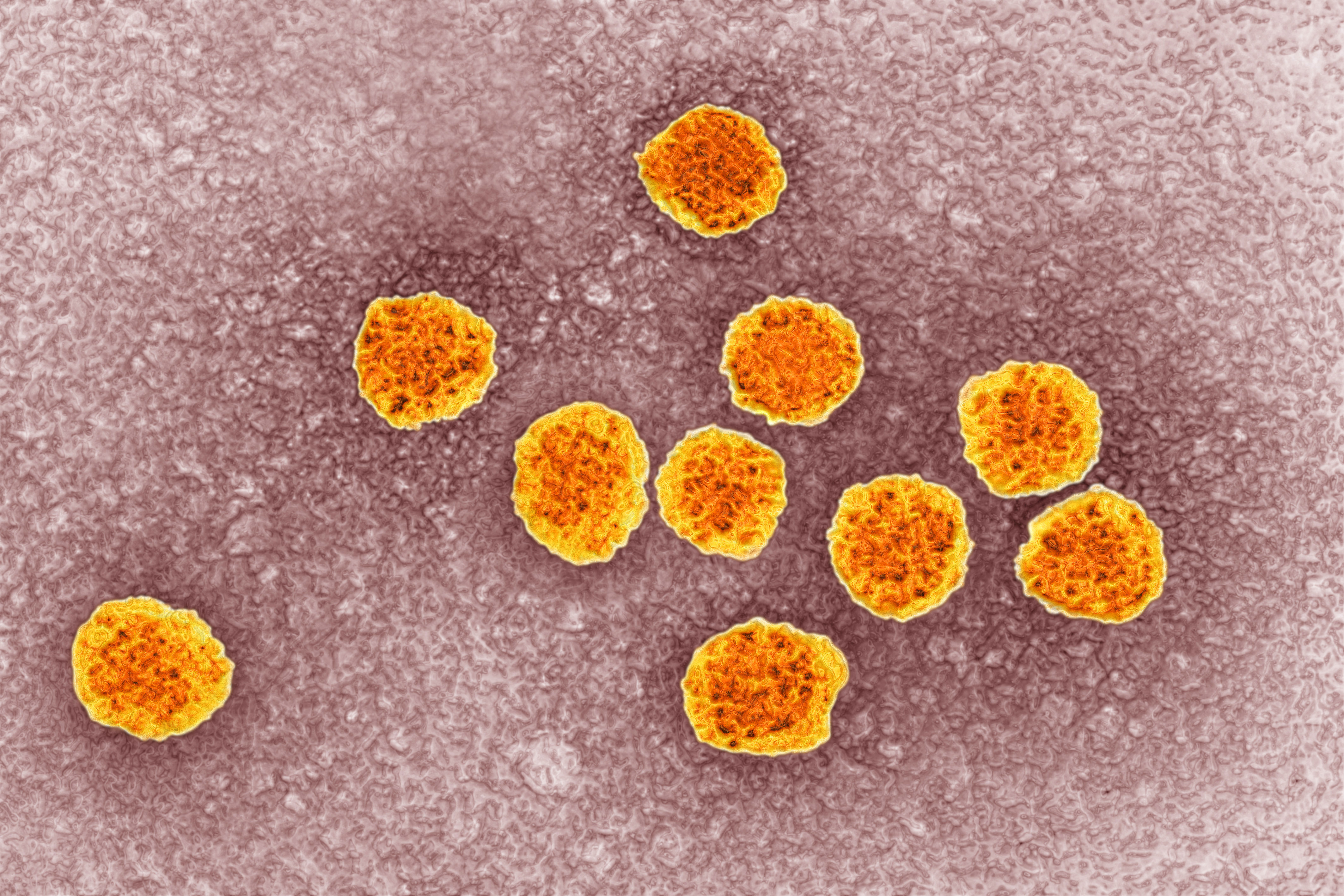 Hepatitis C virus (HCV). Image produced using high-dynamic-range imaging (HDRI) from an image taken with transmission electron microscopy. Viral diameter around 22 nm.