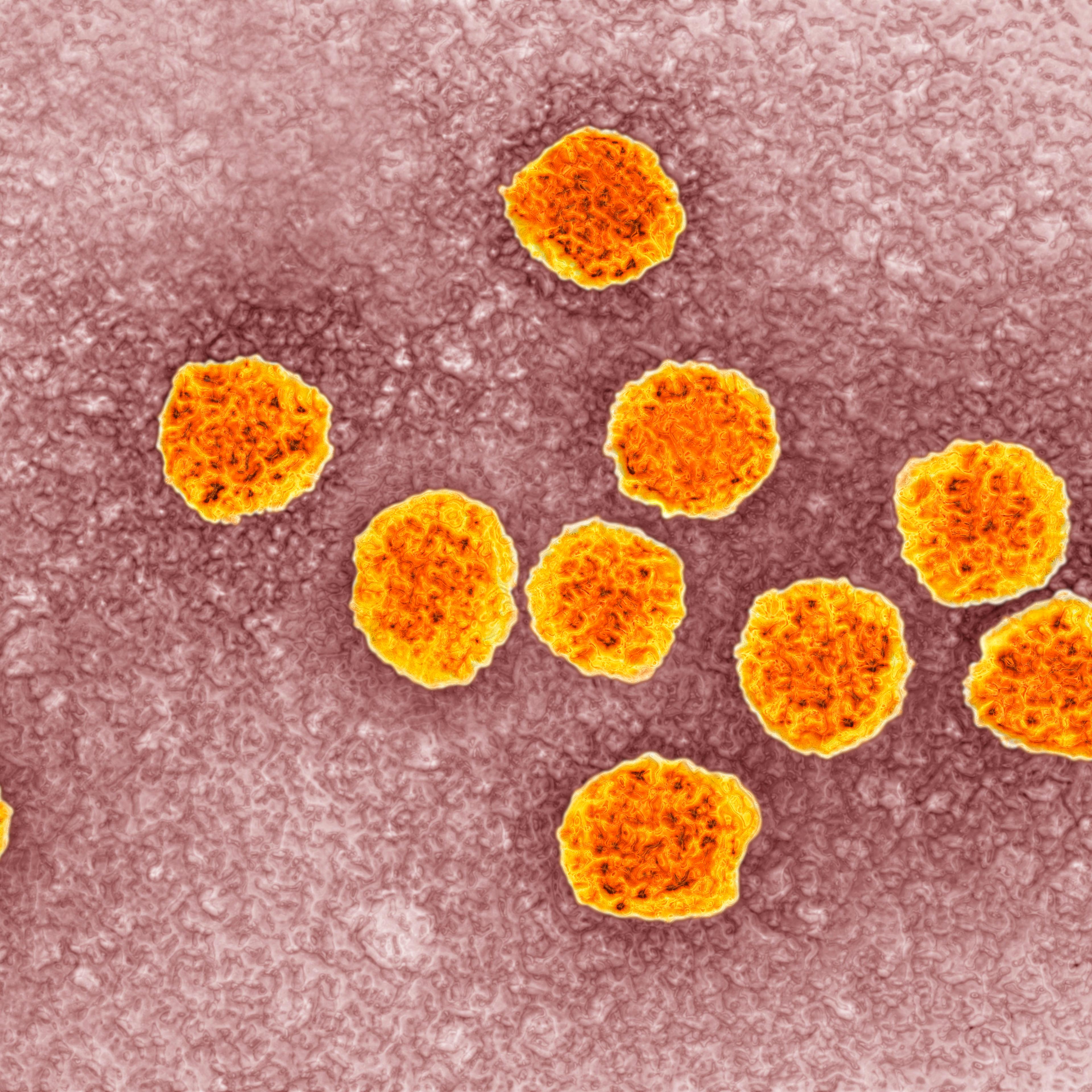 Hepatitis C virus (HCV). Image produced using high-dynamic-range imaging (HDRI) from an image taken with transmission electron microscopy. Viral diameter around 22 nm.