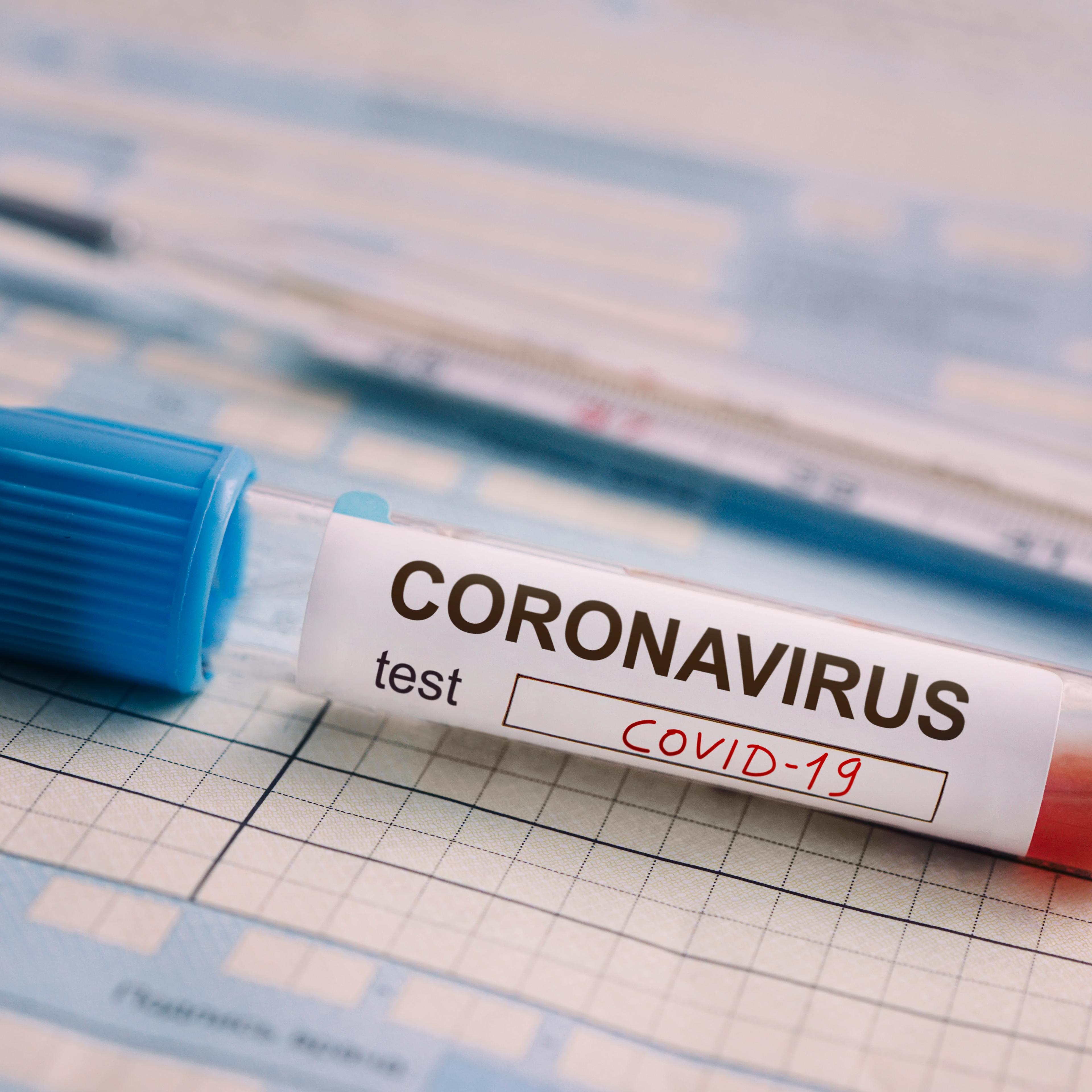 test tube with the blood test is on the table next to the documents. Positive test for coronavirus covid-19. concept of fighting a dangerous Chinese disease.