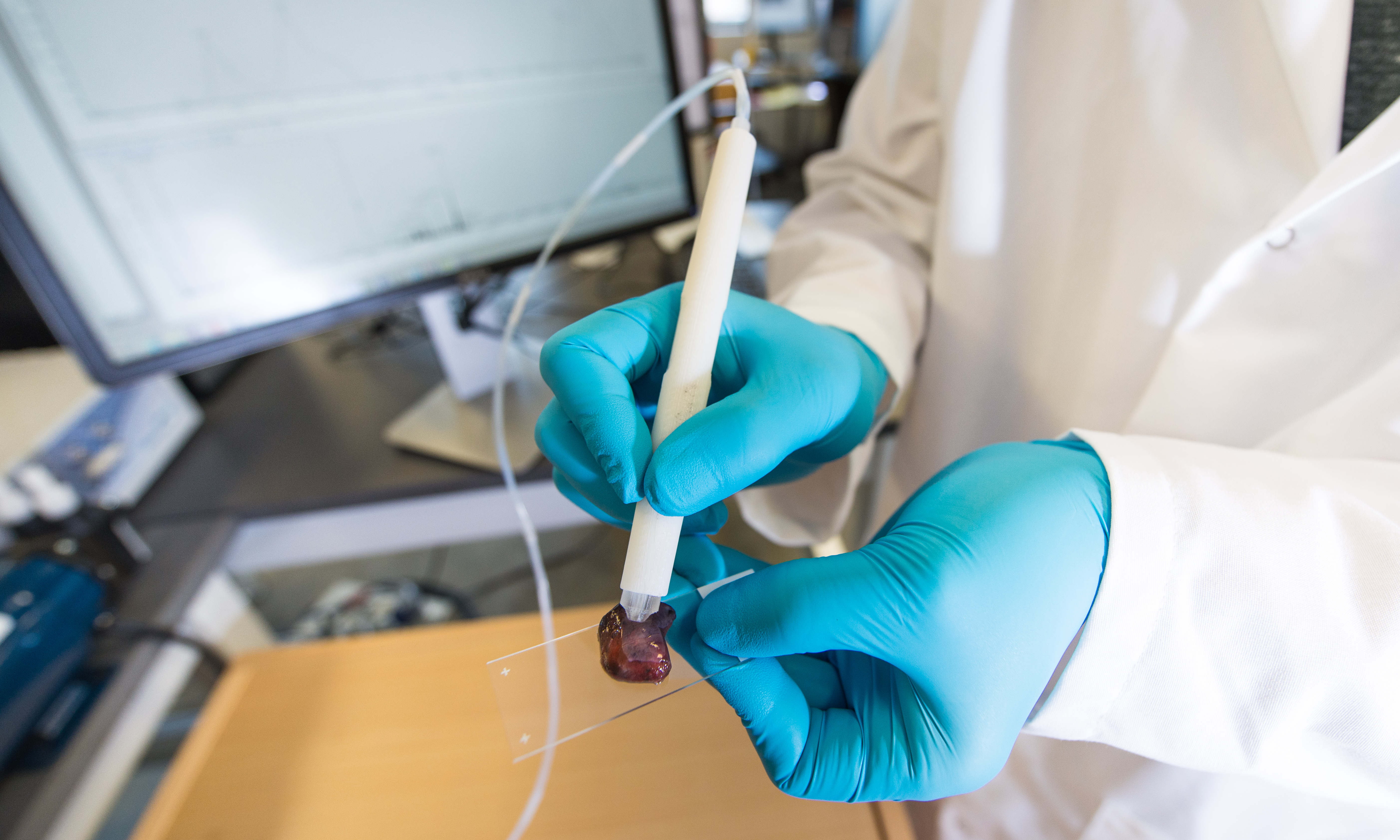 The MasSpec Pen is a handheld probe that can non-destructively analyze human tissue samples to identify cancer.