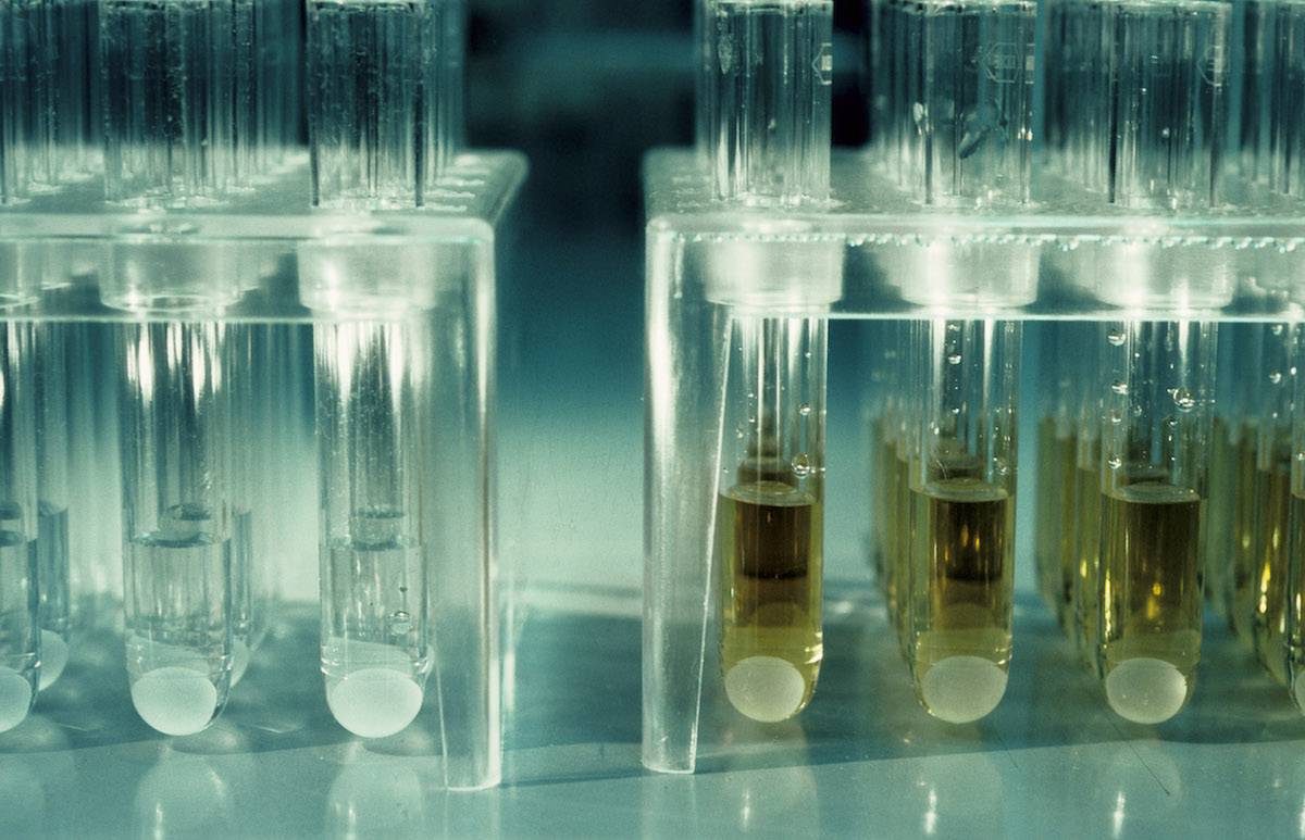 CHE, Switzerland, Basel: Roche company: Aids test, yellow is positive, clear is negative
