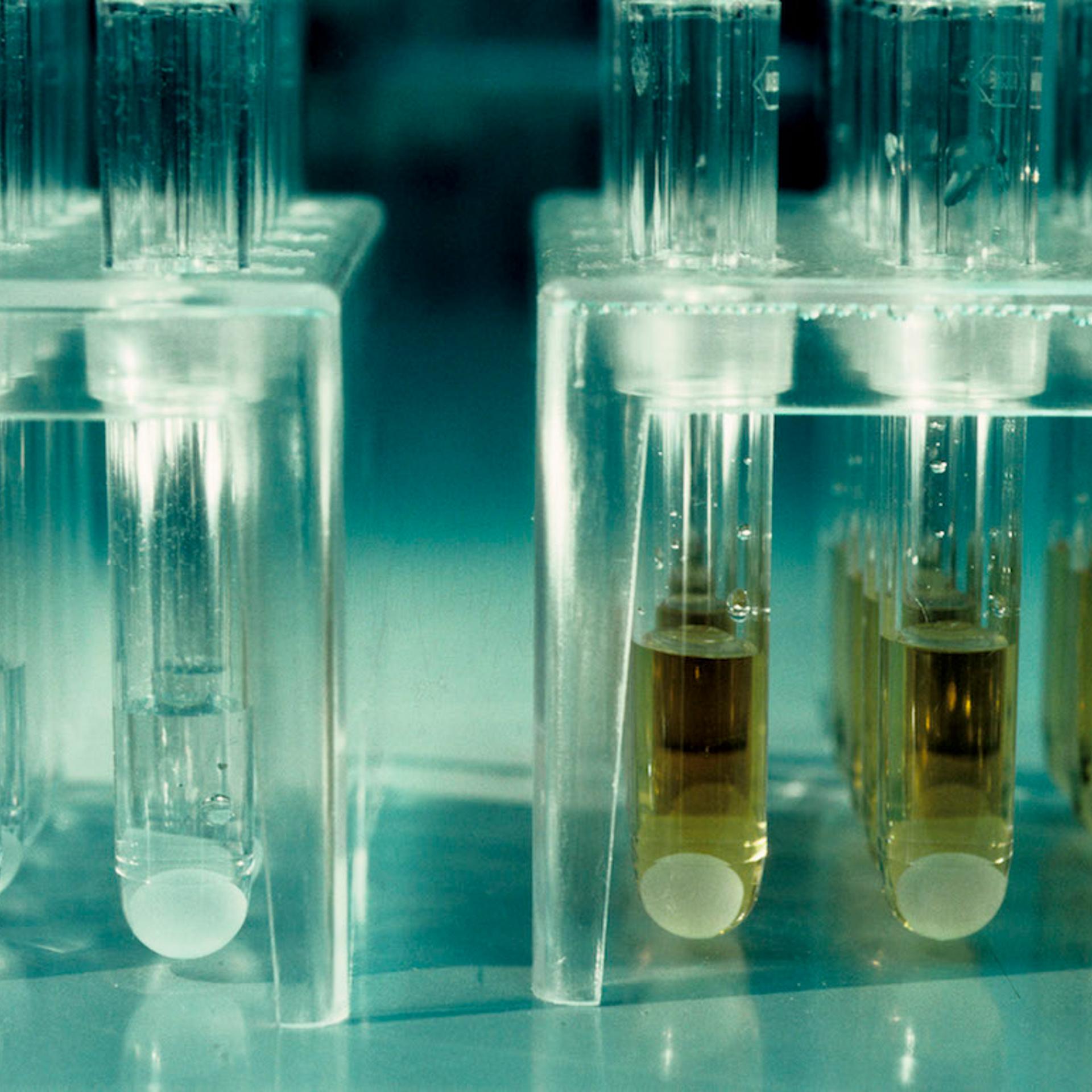 CHE, Switzerland, Basel: Roche company: Aids test, yellow is positive, clear is negative