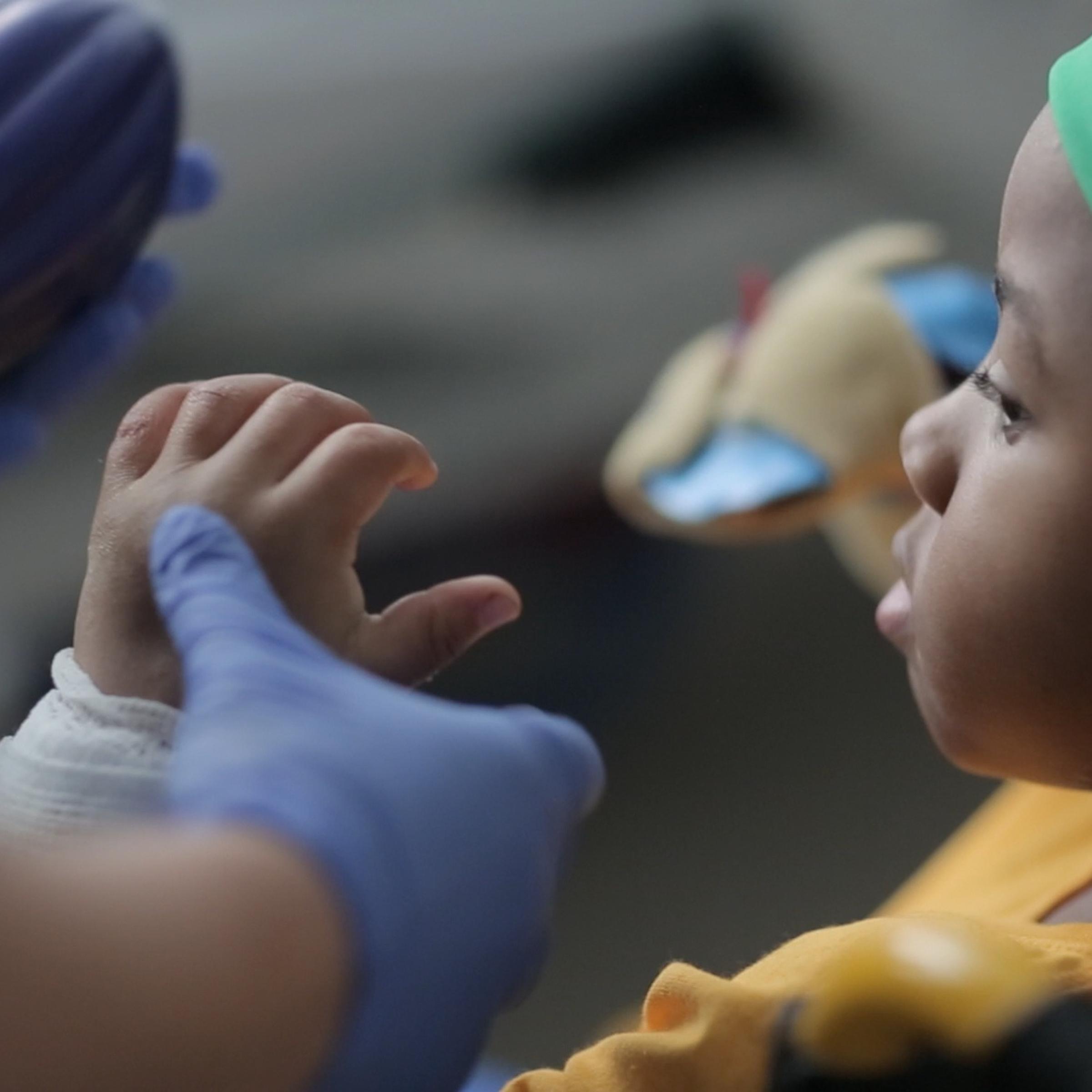 Zion with his new hands after the world's first bilateral hand transplant on a child at The Children's Hospital of Philidelphia.