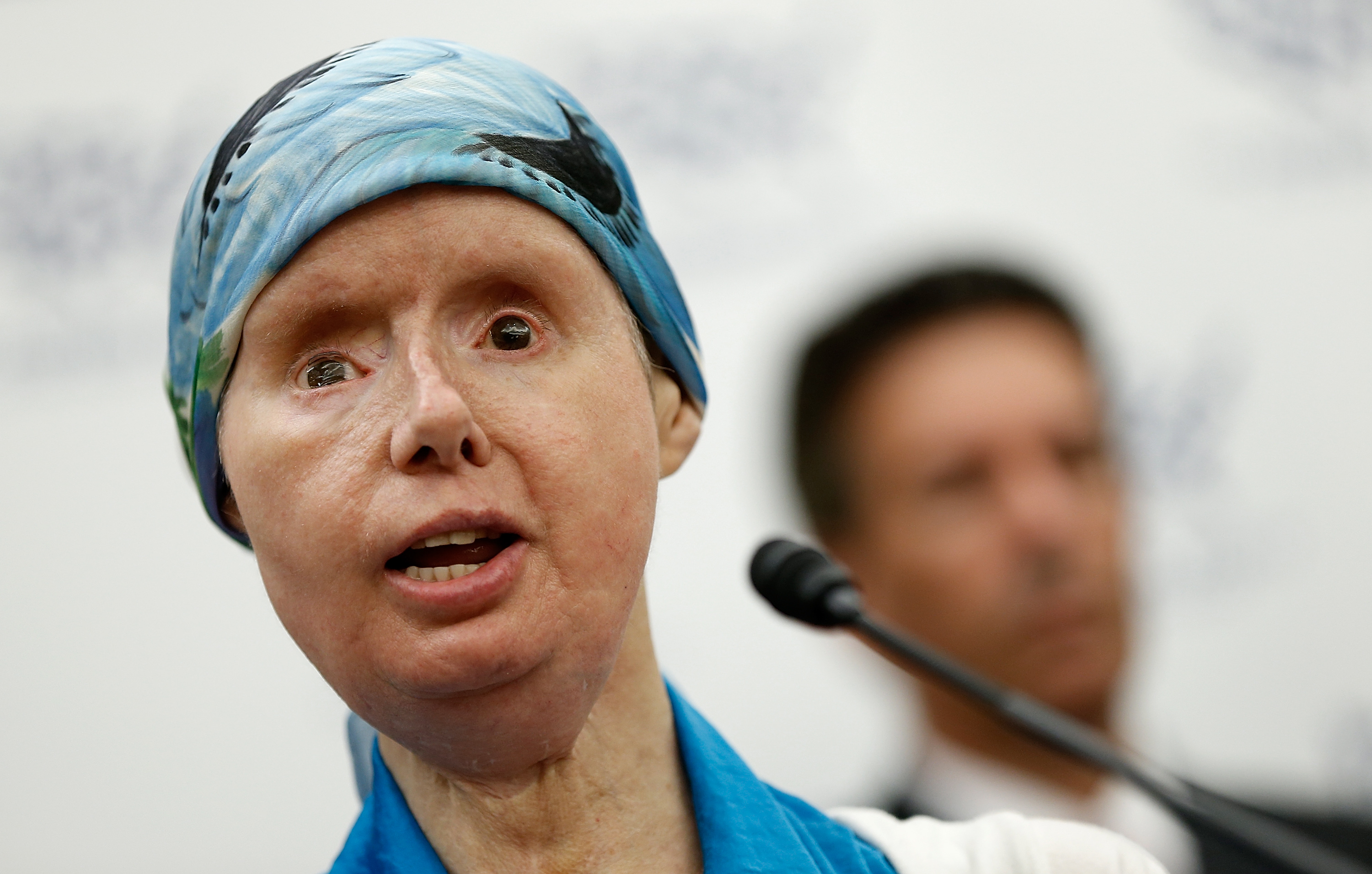 Chimp Attack Victim Lobbies On Capitol Hill To Ban Trade Of Primates As Pets