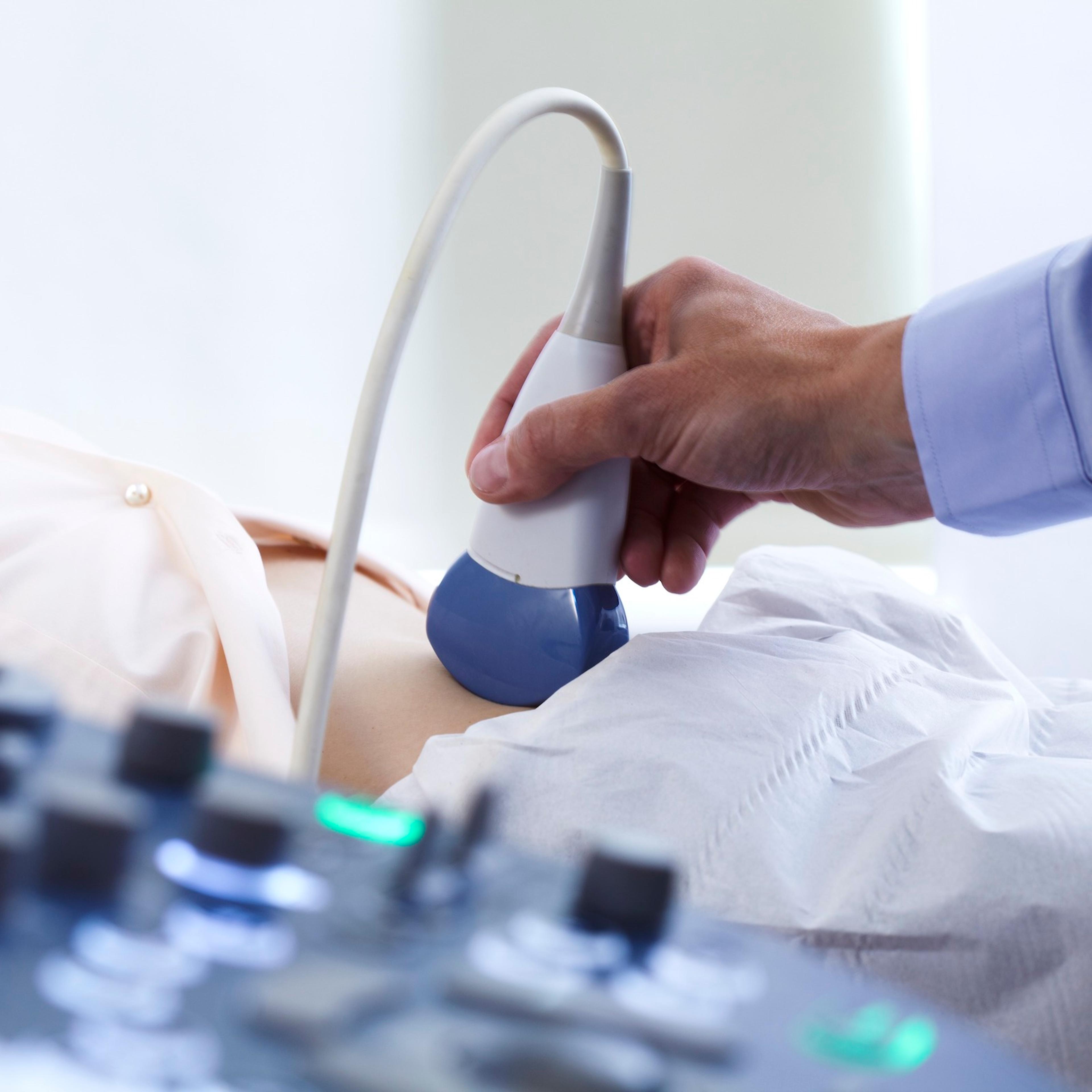 Pregnancy ultrasound scan