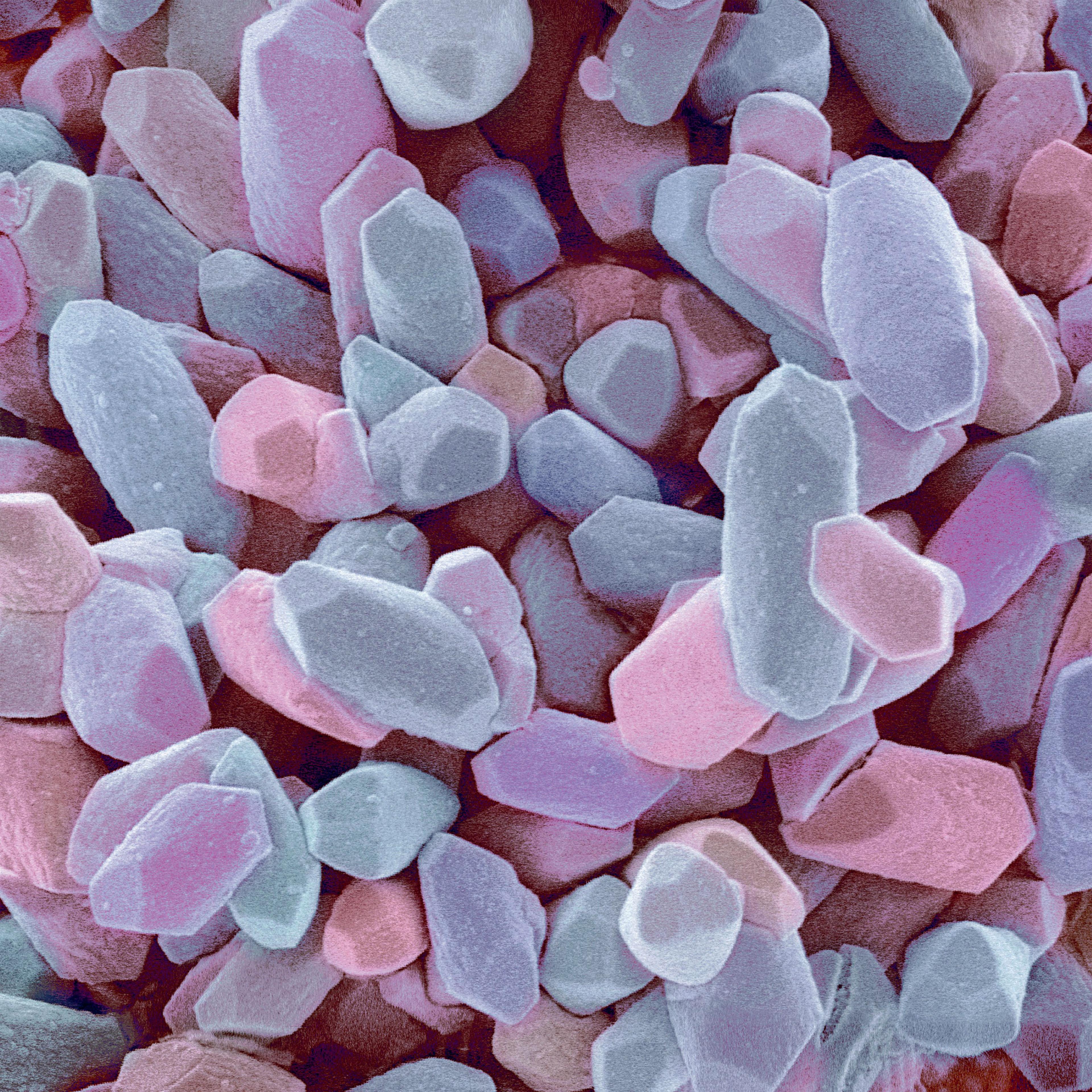 <b>Balancing stone from inner ear</b> (colored scanning electron micrograph)