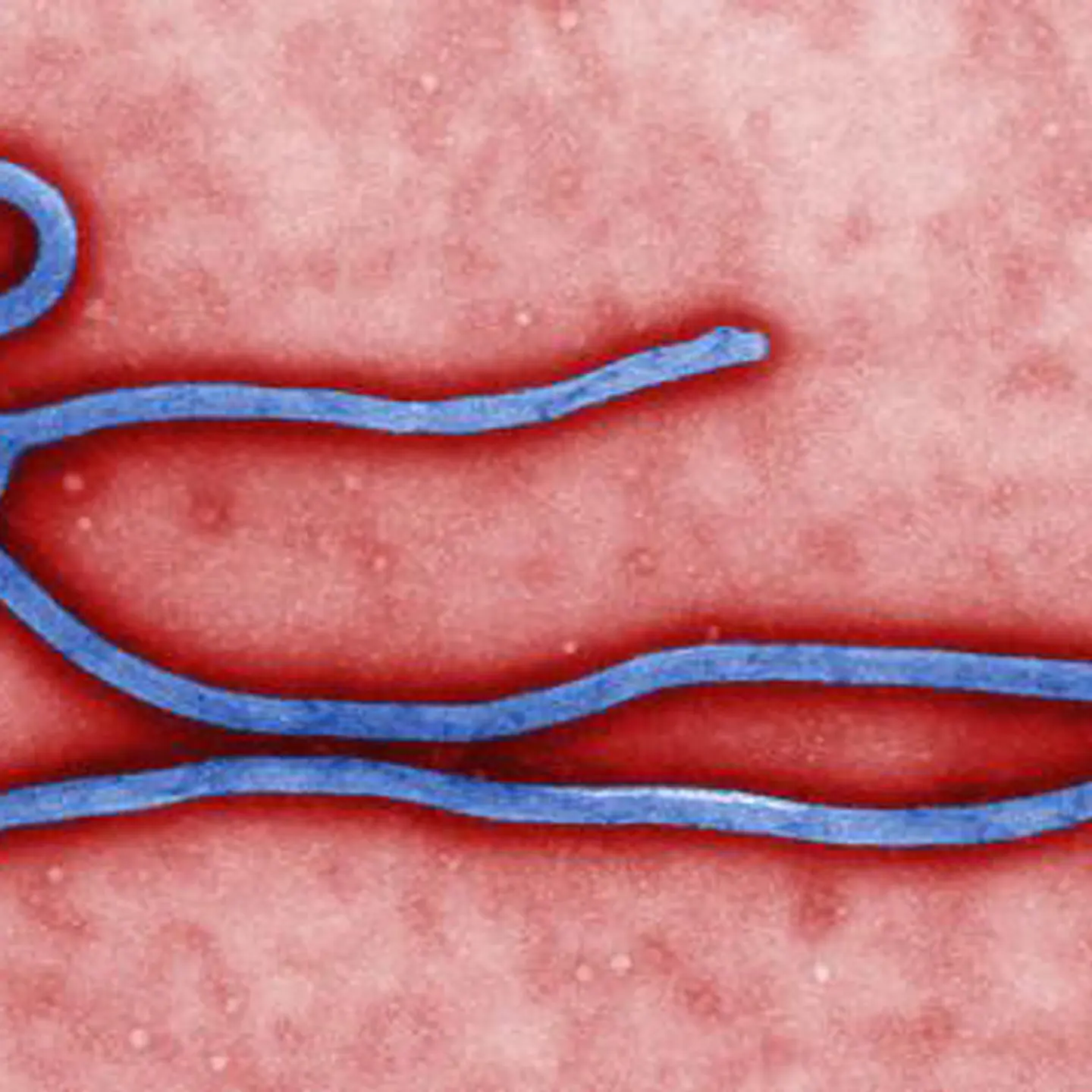 CDC Ebola