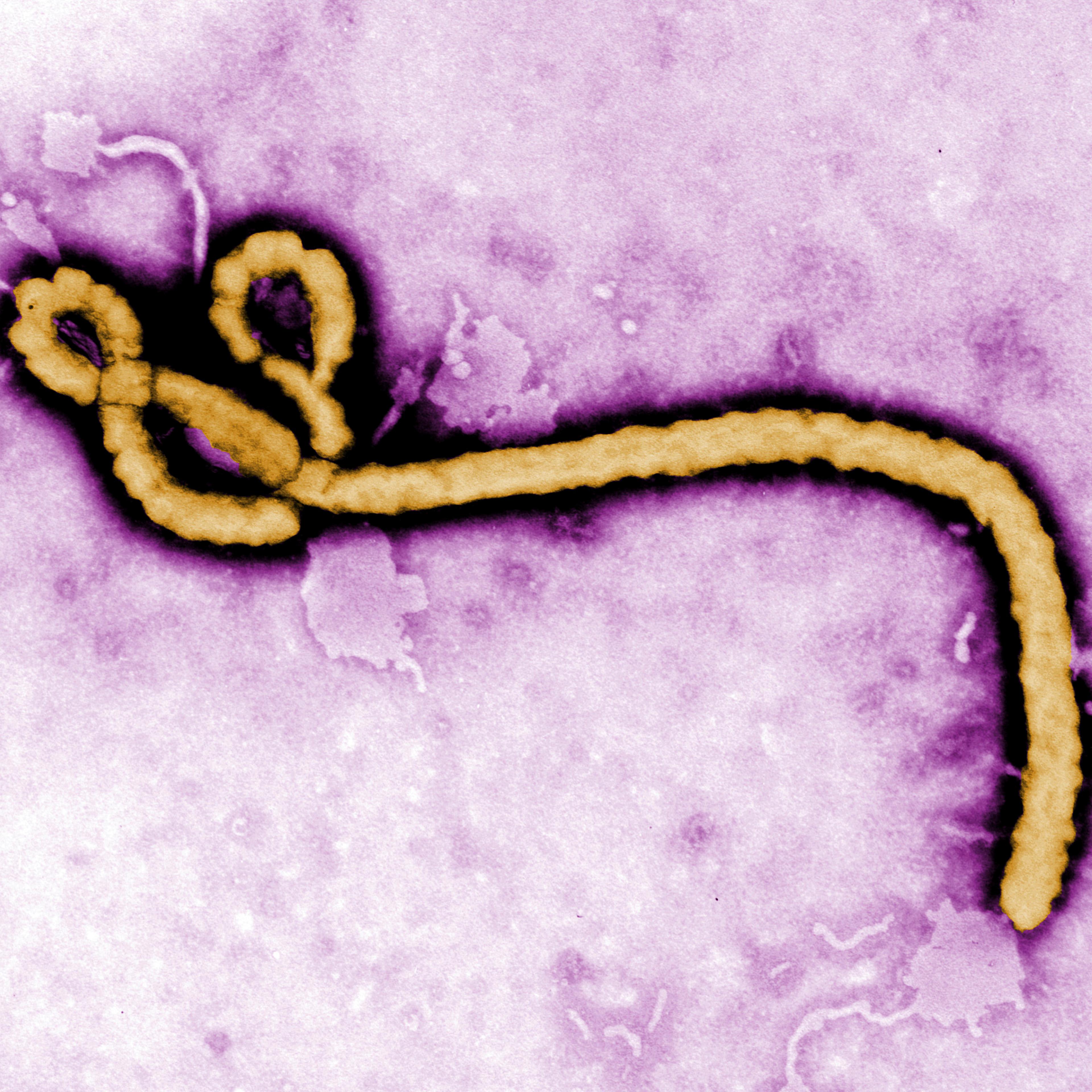 Ebola Congo