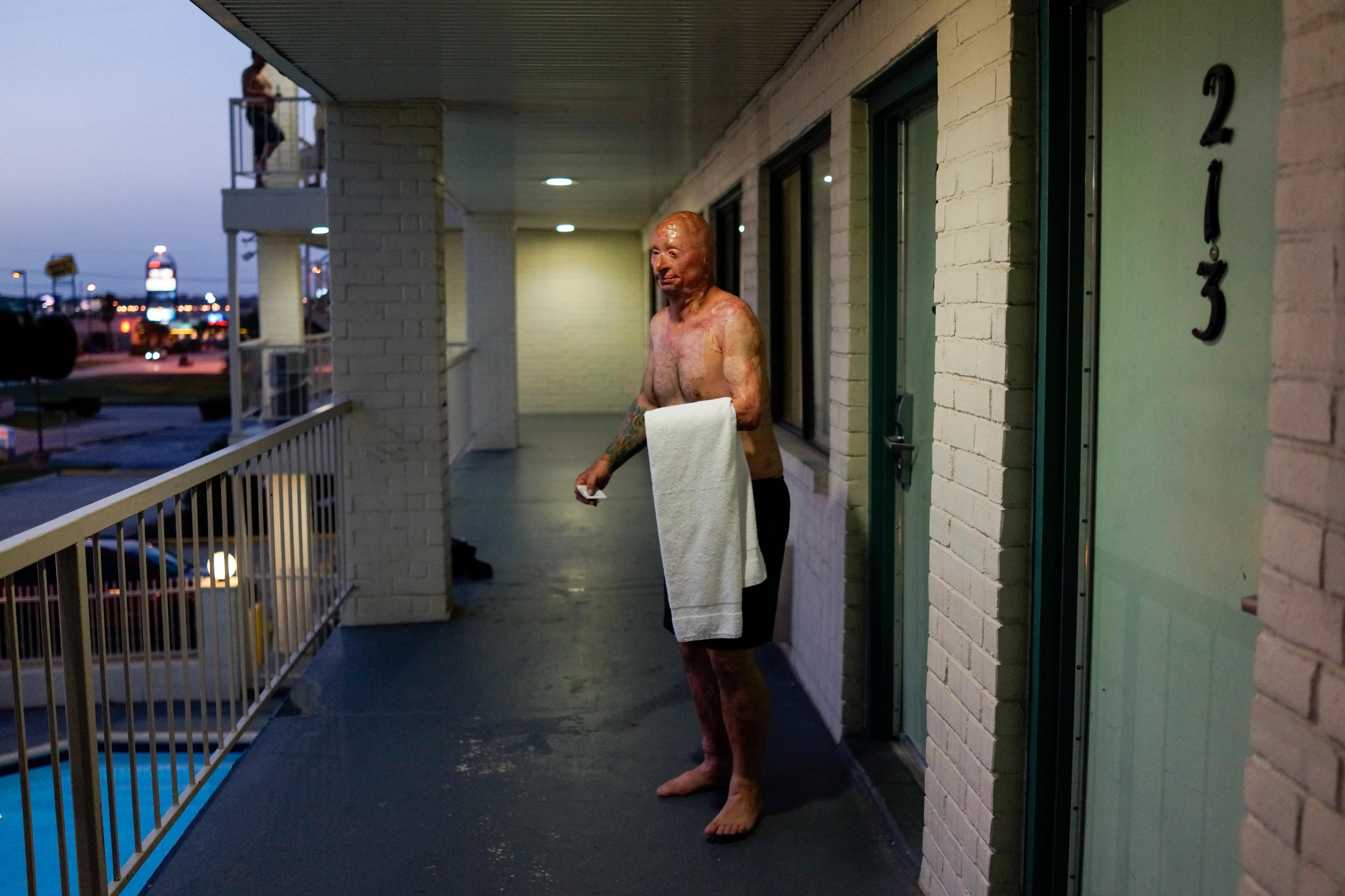 2013. Humble, TX. USA. Bobby steps out of his room to take a swim at a Motel 6 after visiting the father of Rodney McCandless. Rodney was killed in the IED explosion that injured Bobby. For years McCandless's family didn't know that anyone had survived t