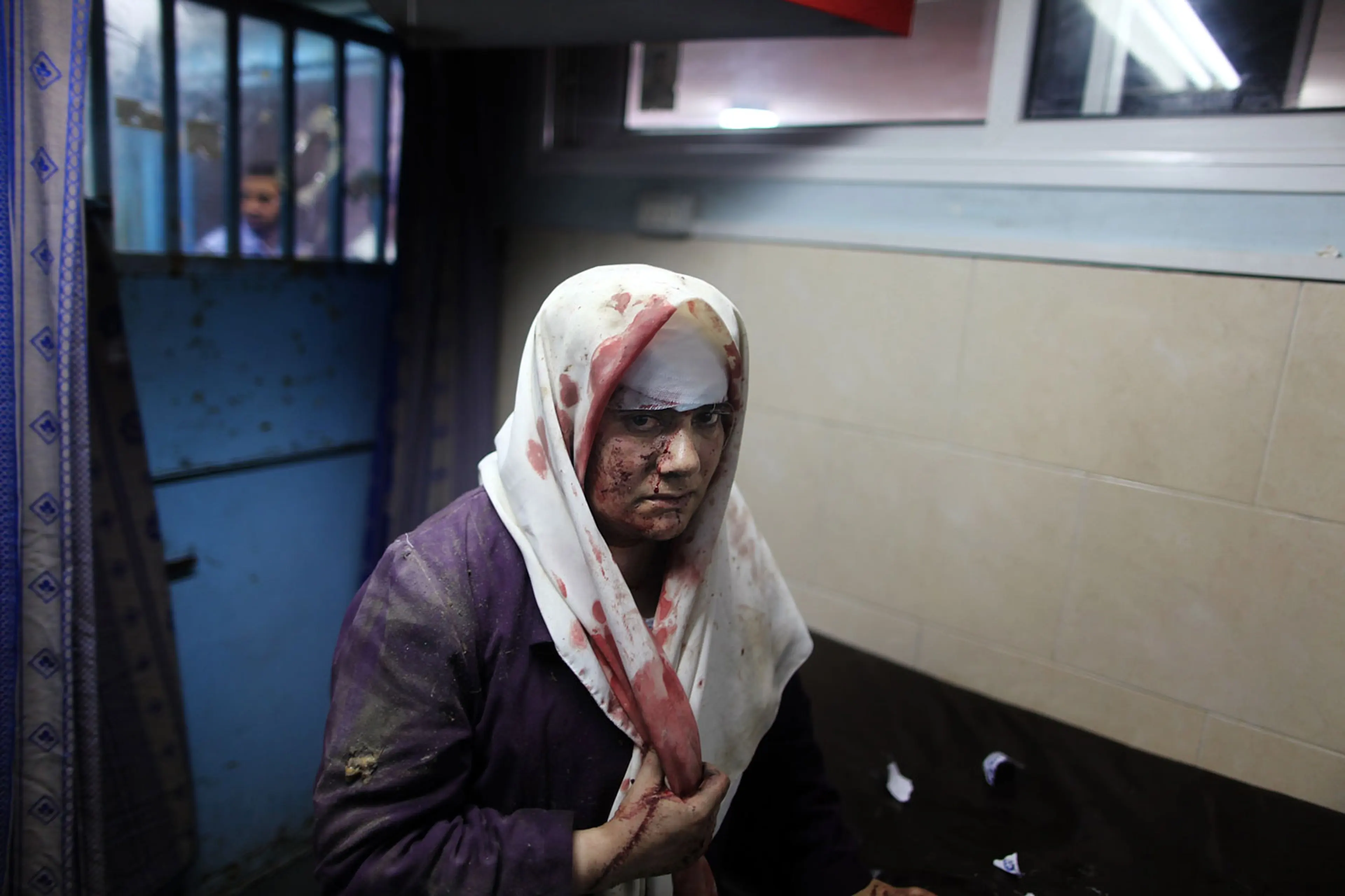 A Palestinian woman, who medics said was wounded by Israeli shelling, receives treatment at al-Shifa hospital in Gaza City, July 20, 2014.