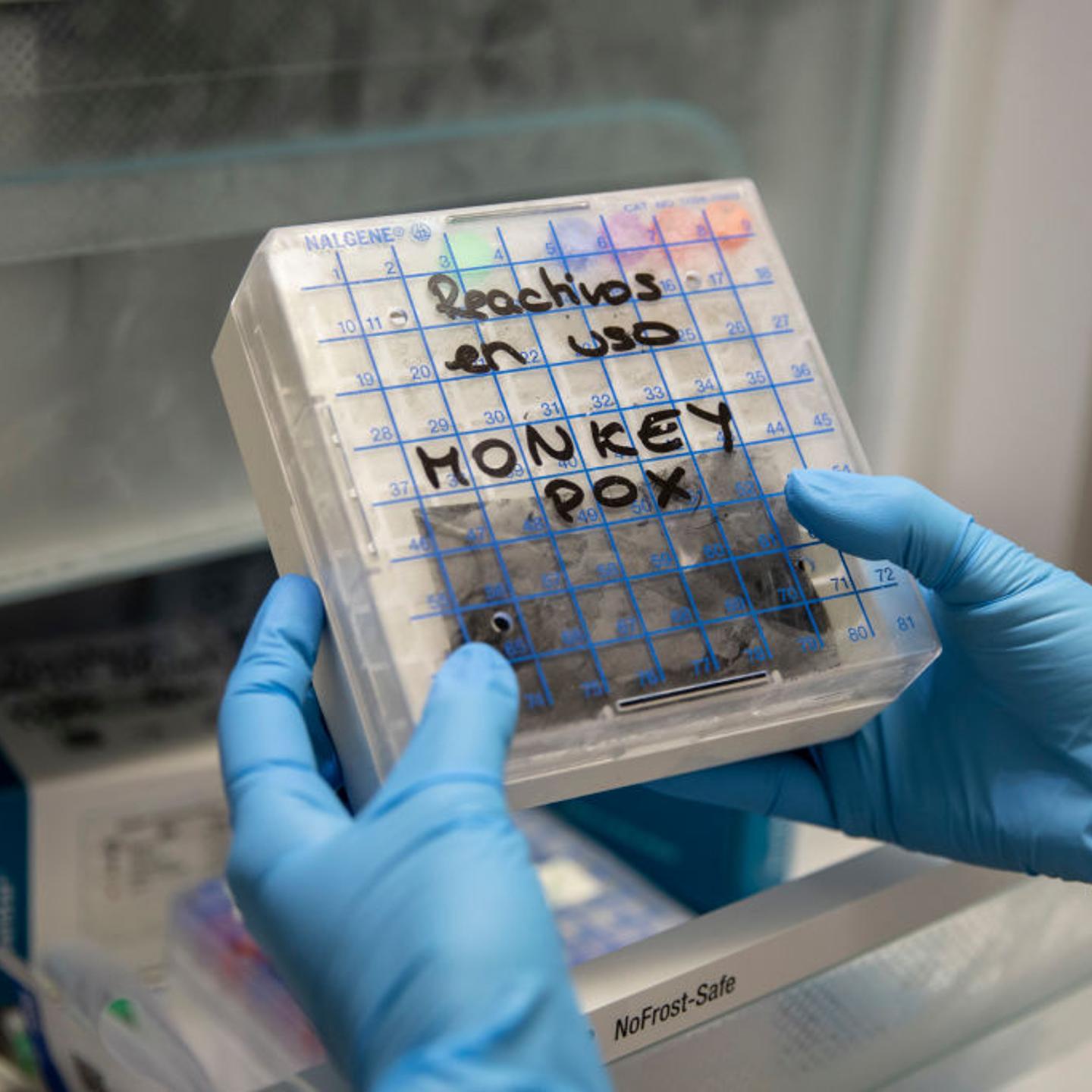 Spain Sets Up Monkeypox Testing Site As Cases on The Rise