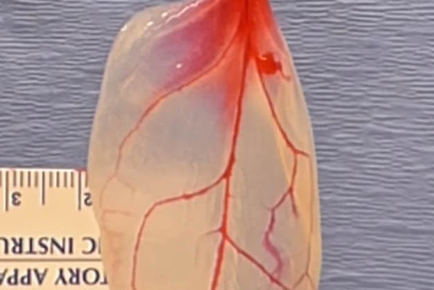 Spinach heart tissue