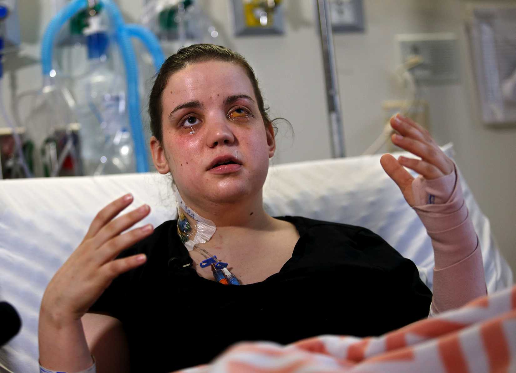 Washington mudslide survivor Amanda Skorjanc, 25, talks to the media while sitting in her hospital bed on Wednesday, April 9, 2014, in Seattle.