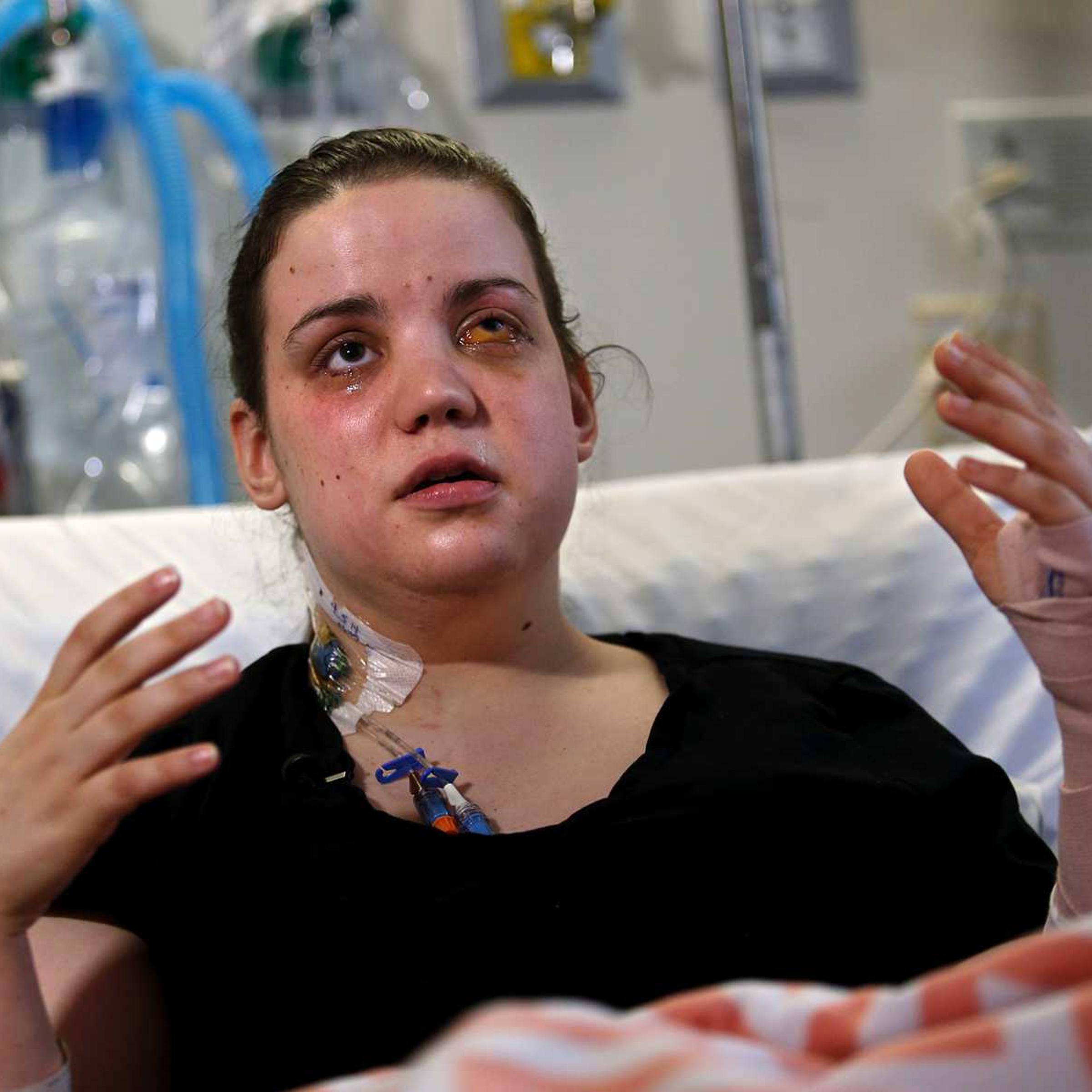 Washington mudslide survivor Amanda Skorjanc, 25, talks to the media while sitting in her hospital bed on Wednesday, April 9, 2014, in Seattle.
