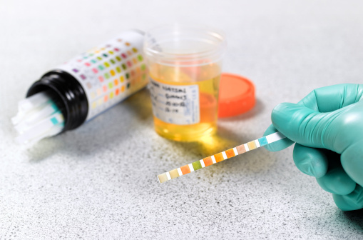 Urine testing stock photo