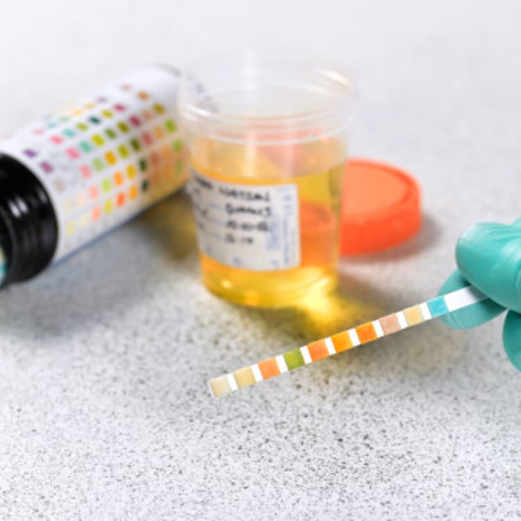 Urine testing stock photo