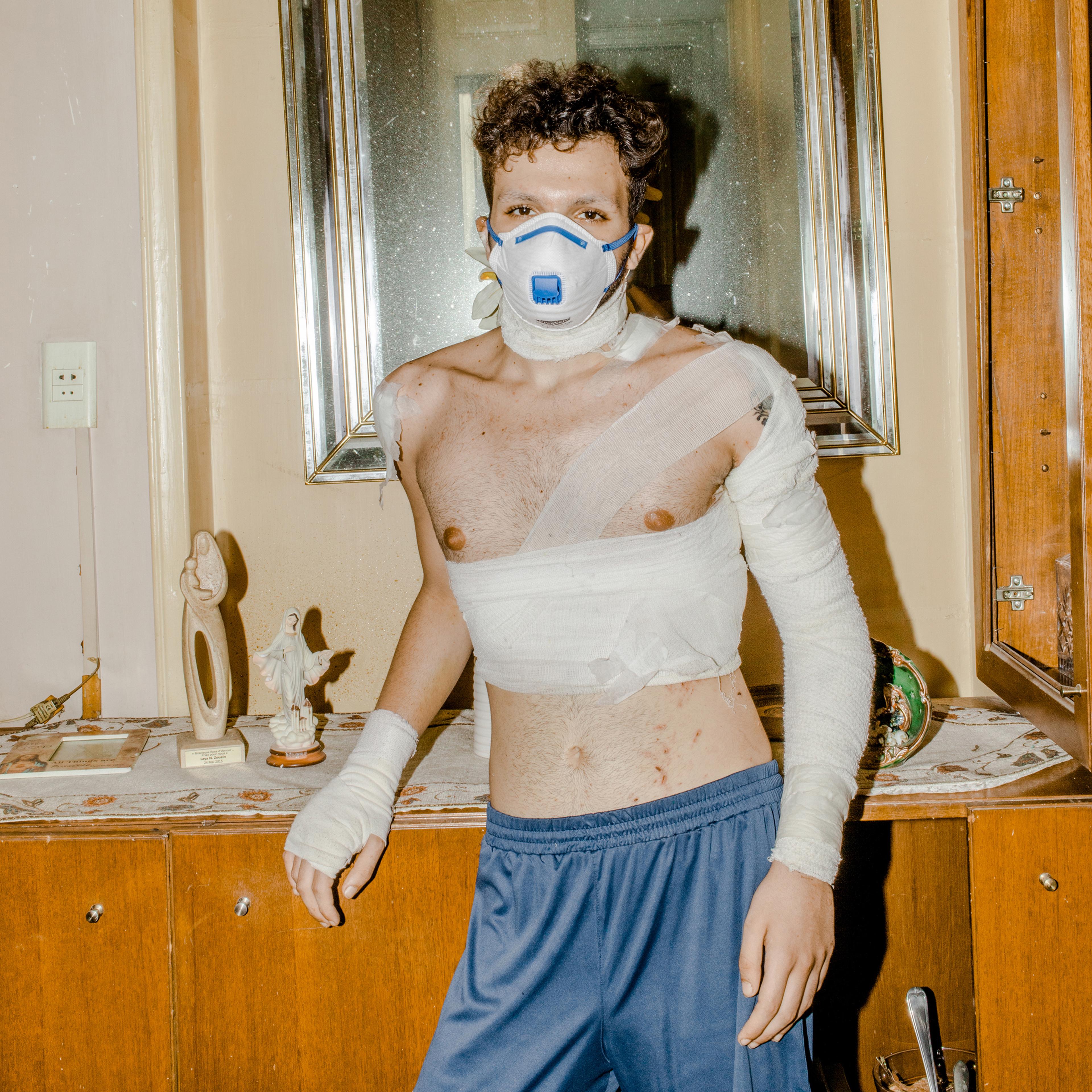 “I felt like I went to hell for seven hours and then I came out of it,” recalls Andrea, a drag performer in Beirut who was injured in the port explosion.