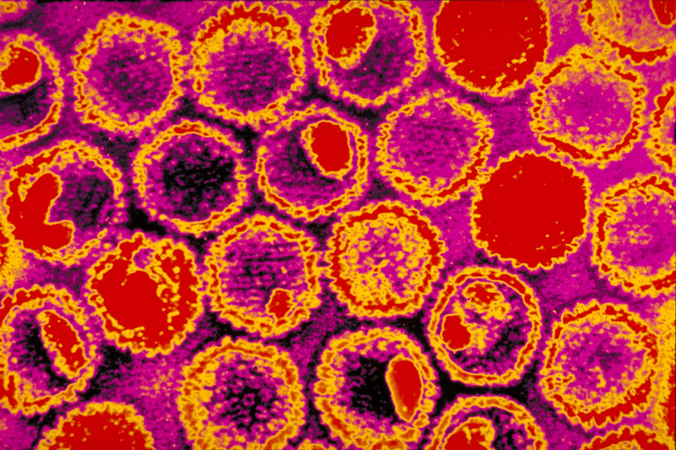 Herpes virus