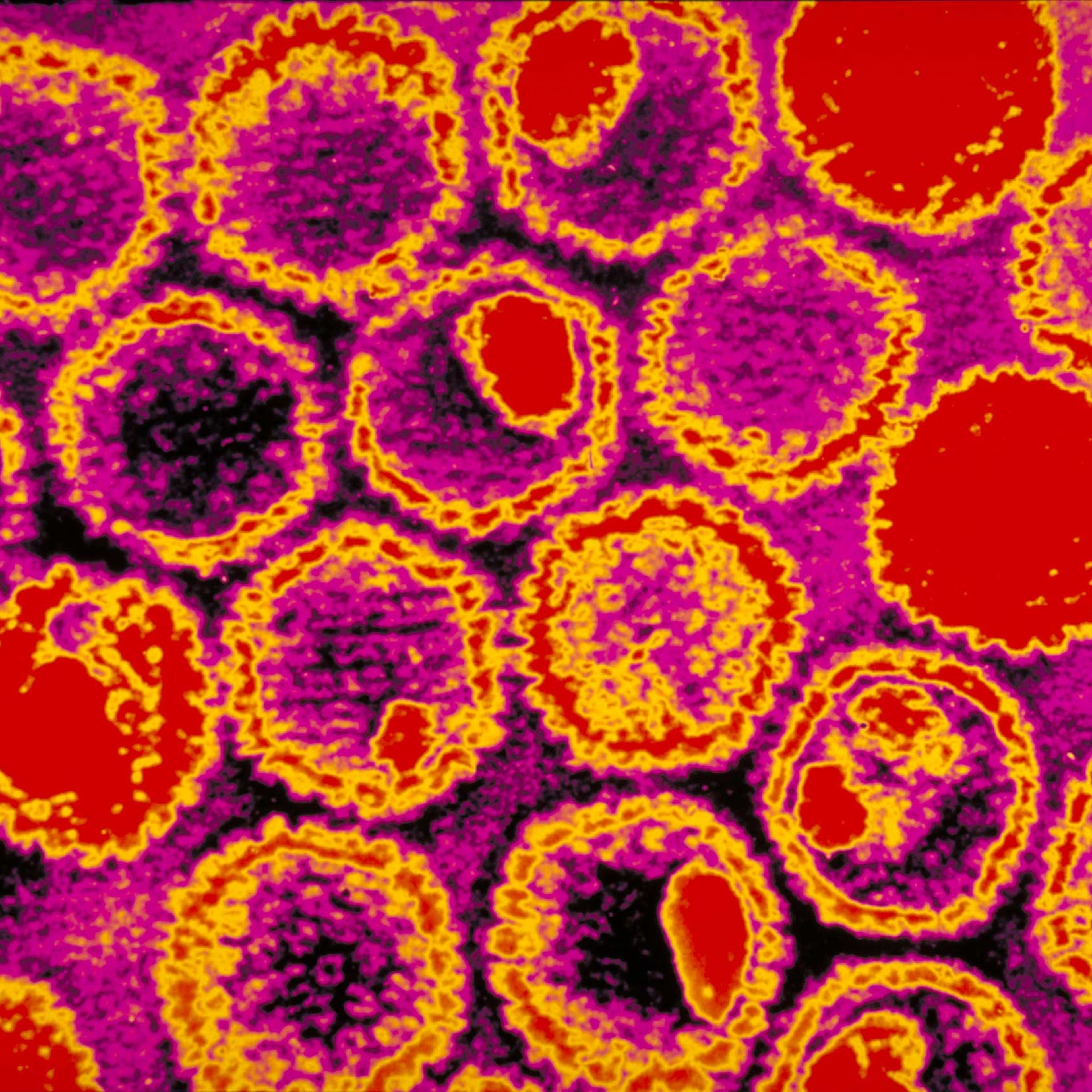 Herpes virus