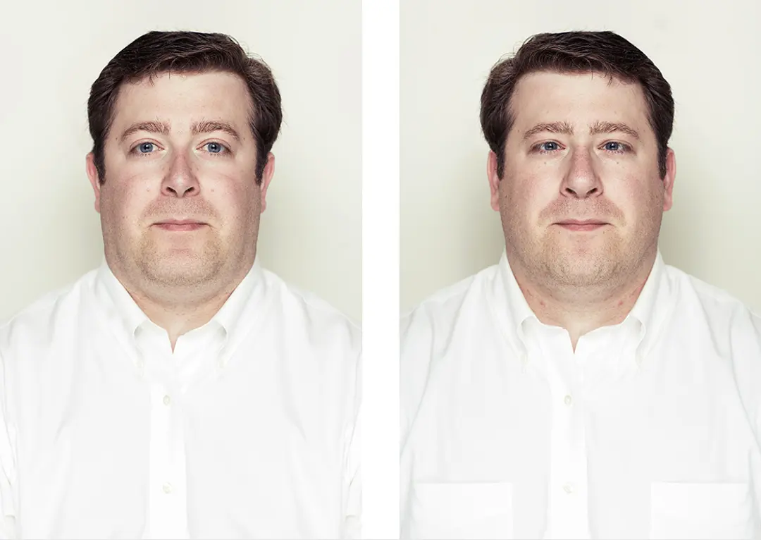 Symmetrical Face Example Photos: What Symmetrical Faces Really Look Like
