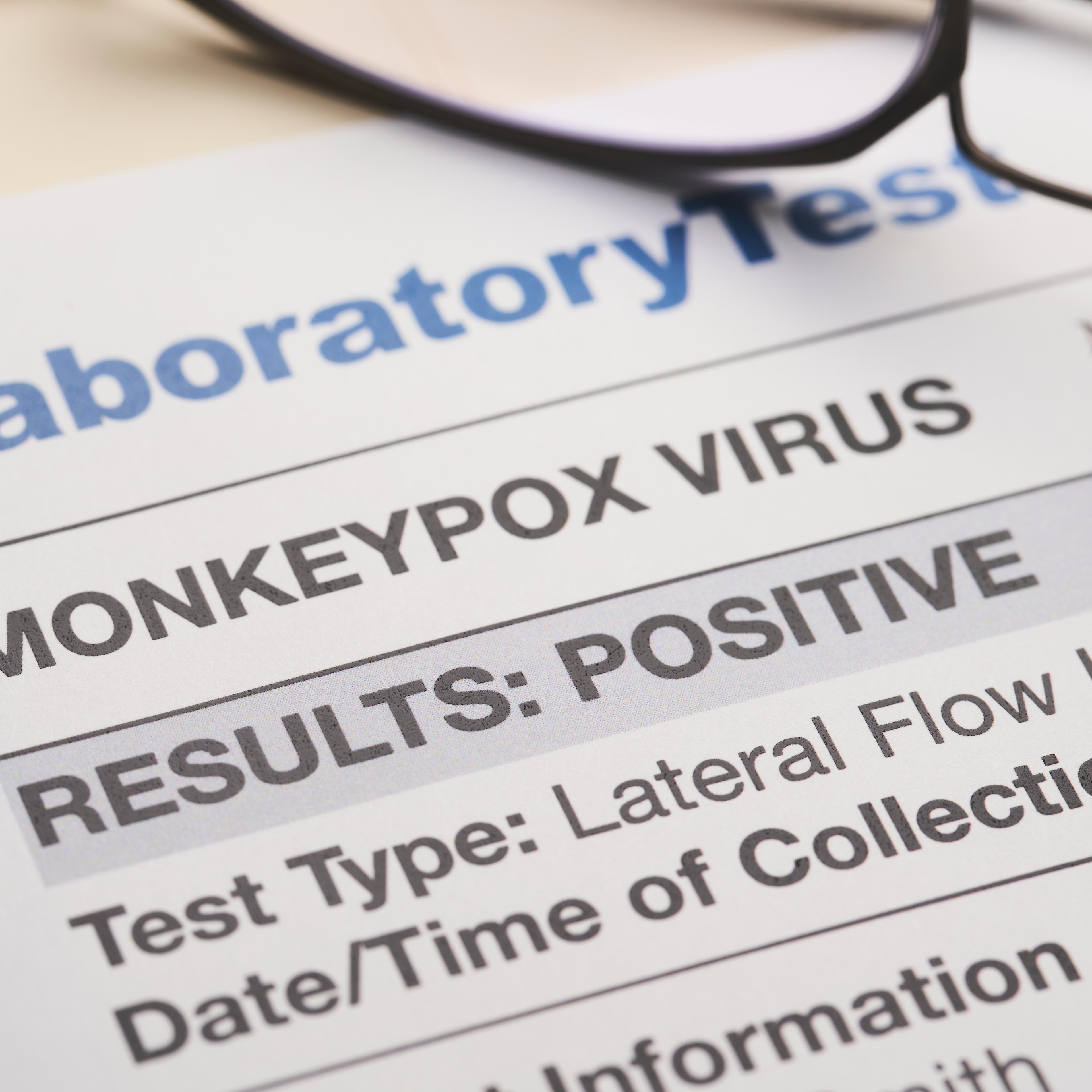 Monkeypox-virus-test