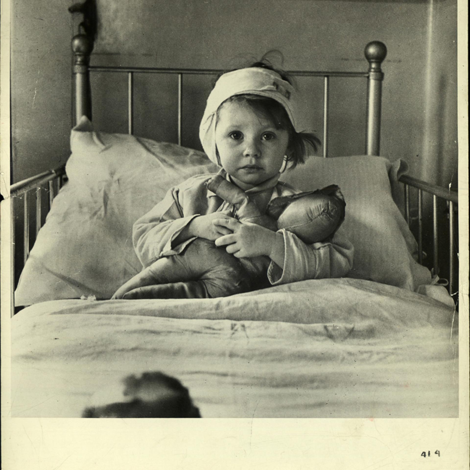 Three-year-old Eileen Dunne, a victim of the London Blitz, in hospital, 1940.