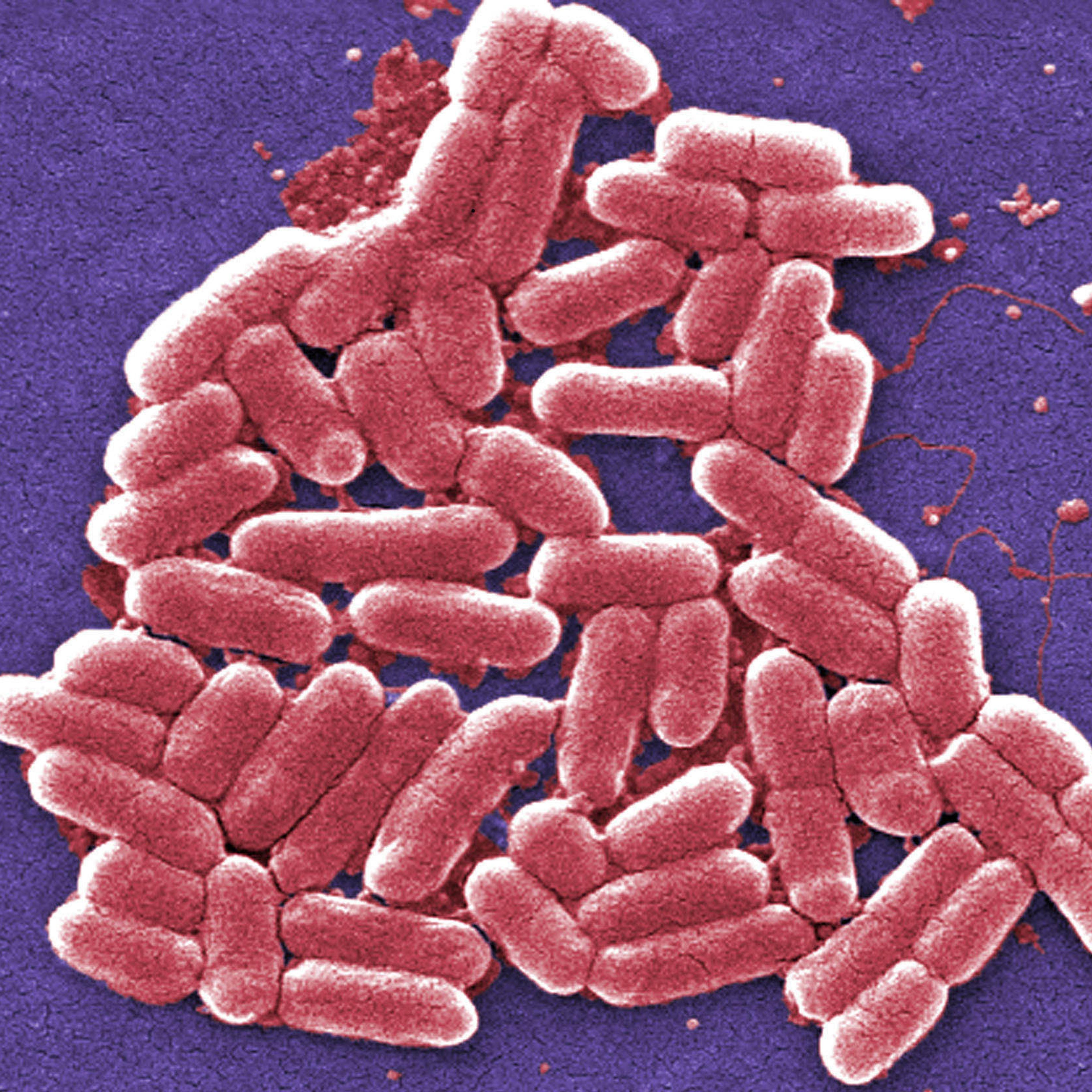 This 2006 colorized scanning electron micrograph image made available by the Centers for Disease Control and Prevention shows the O157:H7 strain of the E. coli bacteria.