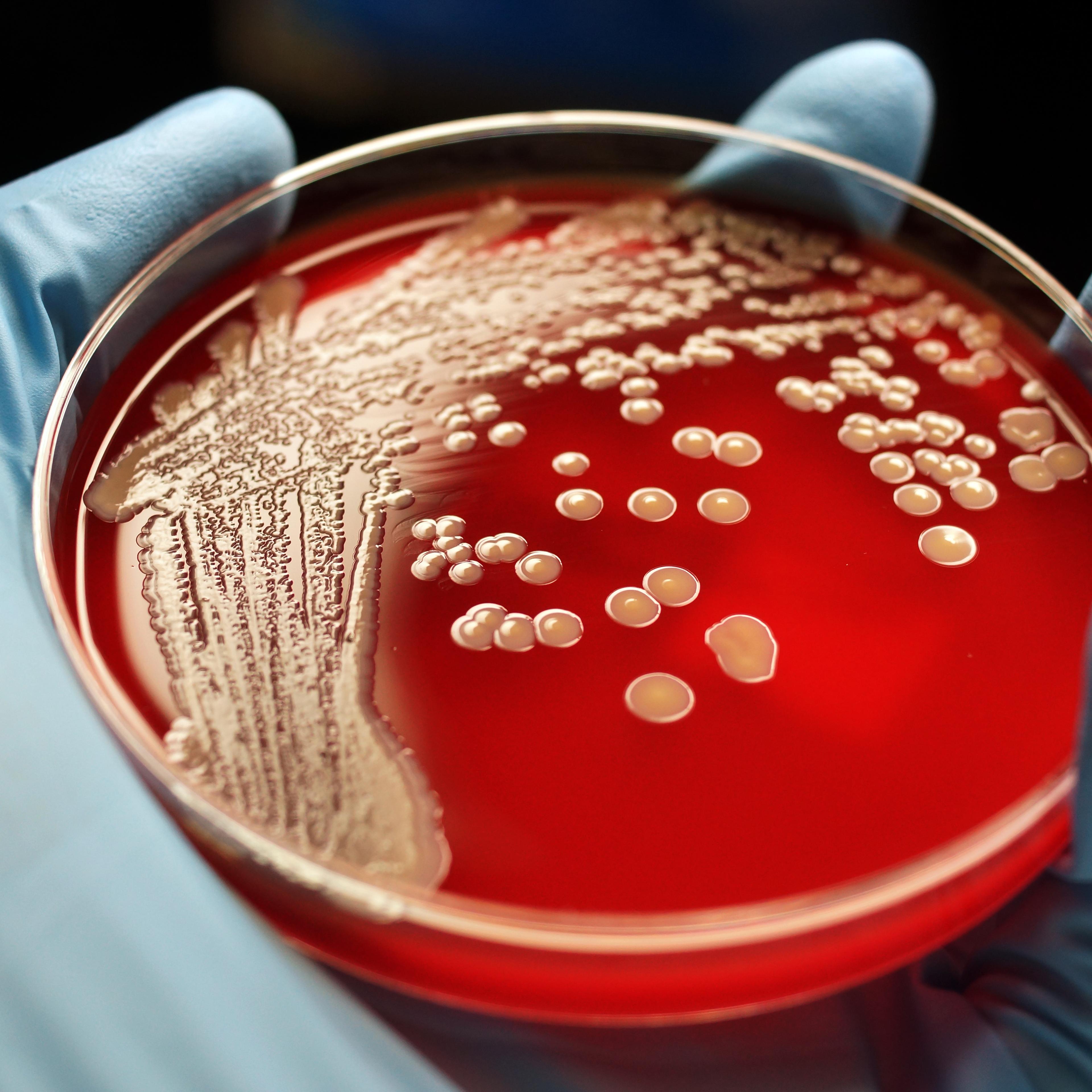 MRSA colonies on blood agar plate