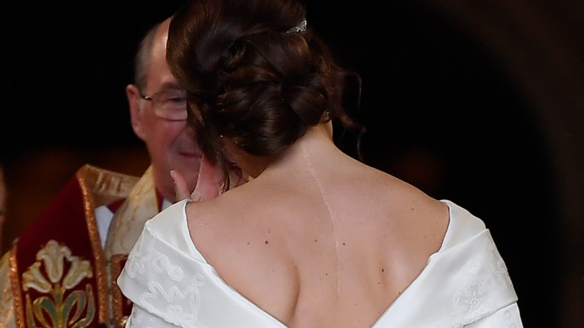 princess eugenie wedding dress scar Princess Eugenie wedding: Royal inspires others by showing scar