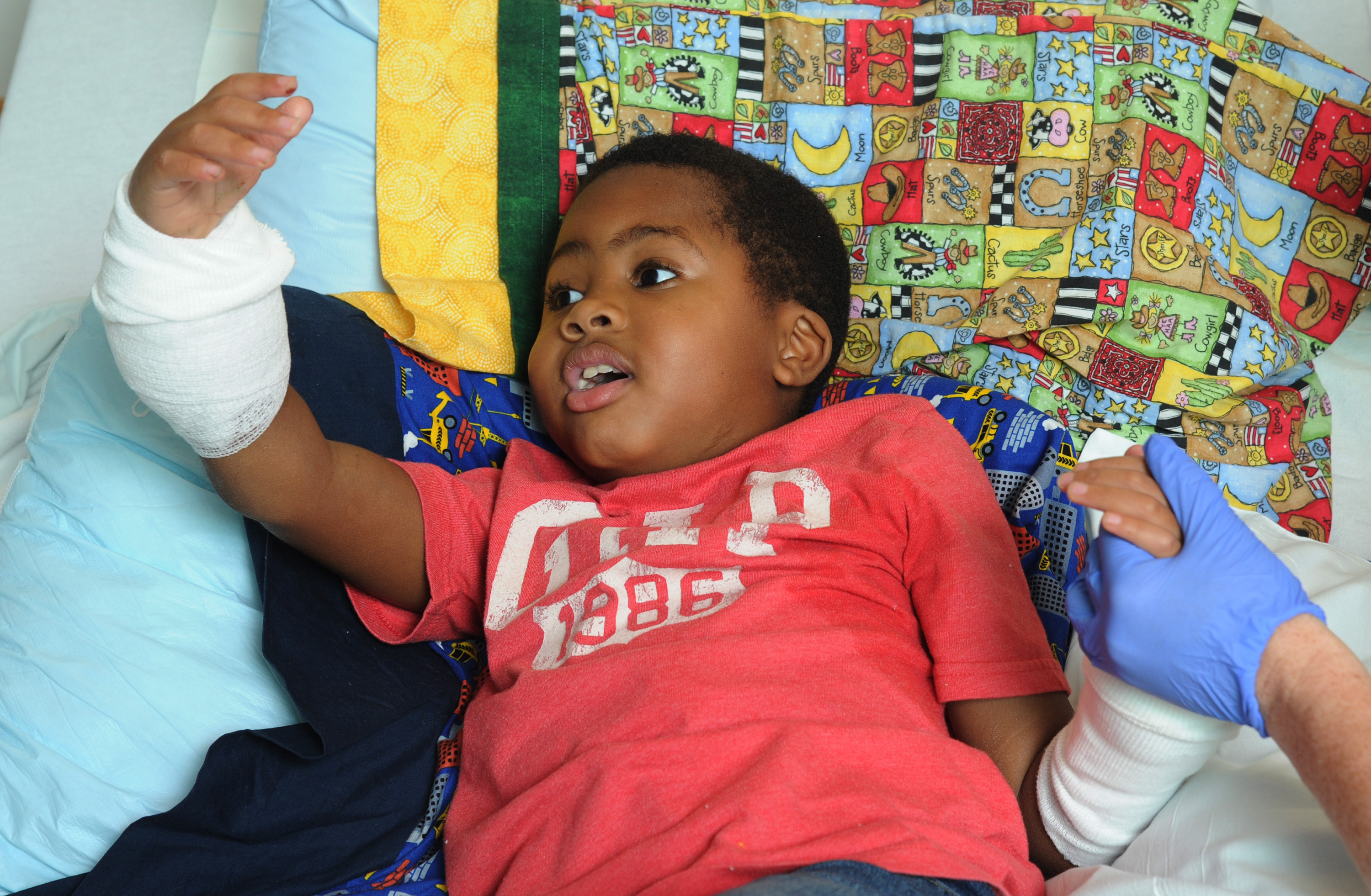 8-year-old Baltimore boy the world?s first pediatric double-hand transplant recipient