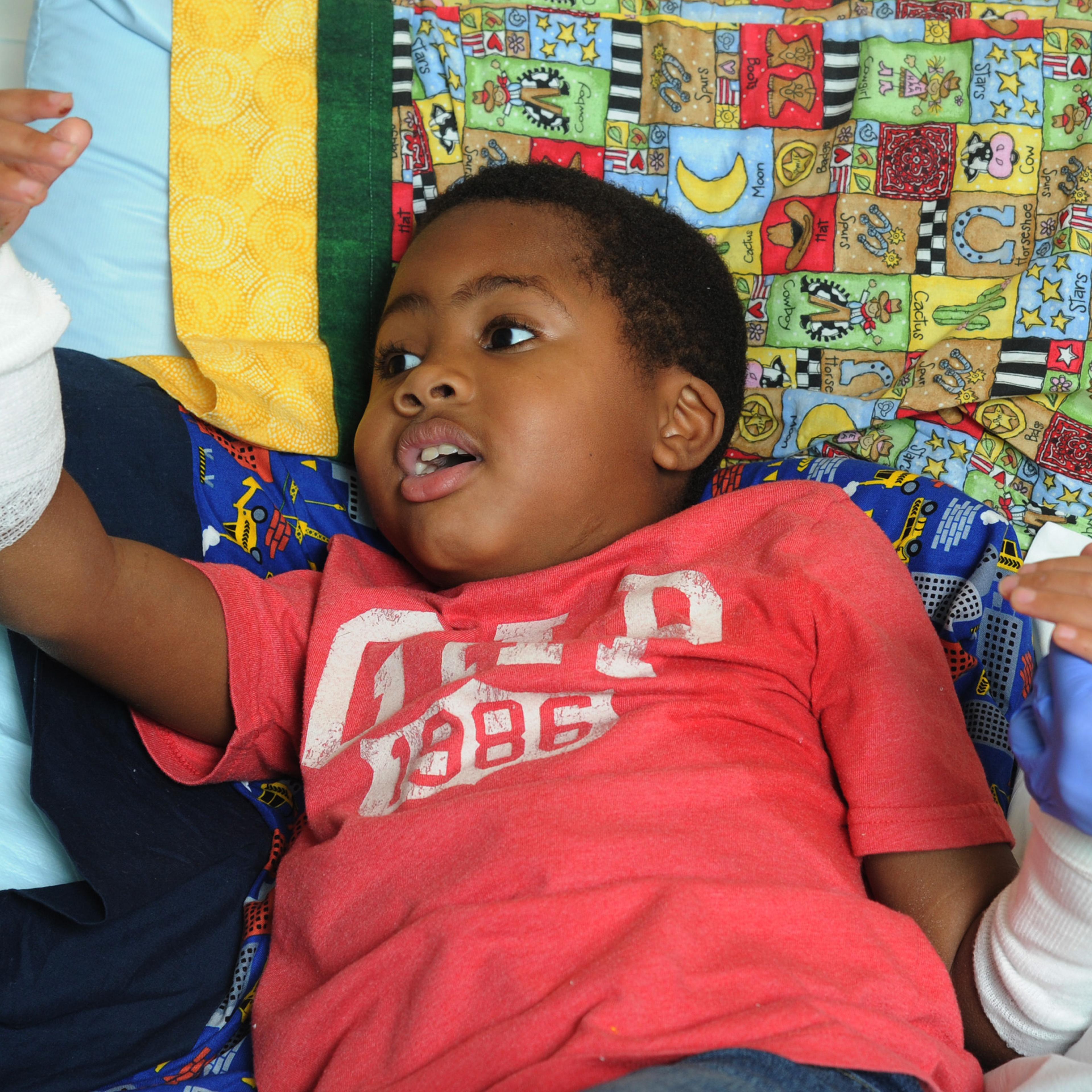 8-year-old Baltimore boy the world?s first pediatric double-hand transplant recipient