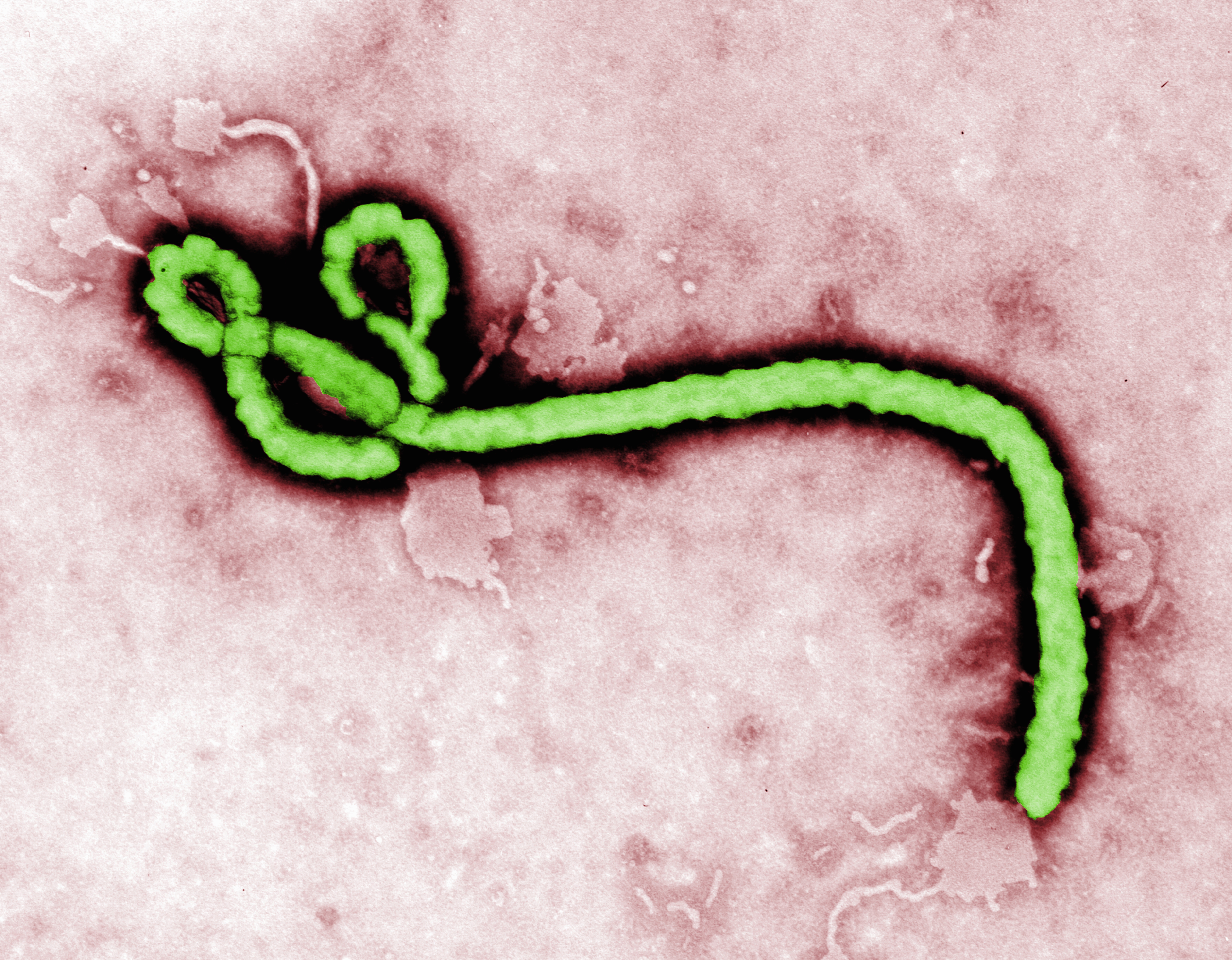 Transmission electron micrograph (TEM) of an Ebola virus virion