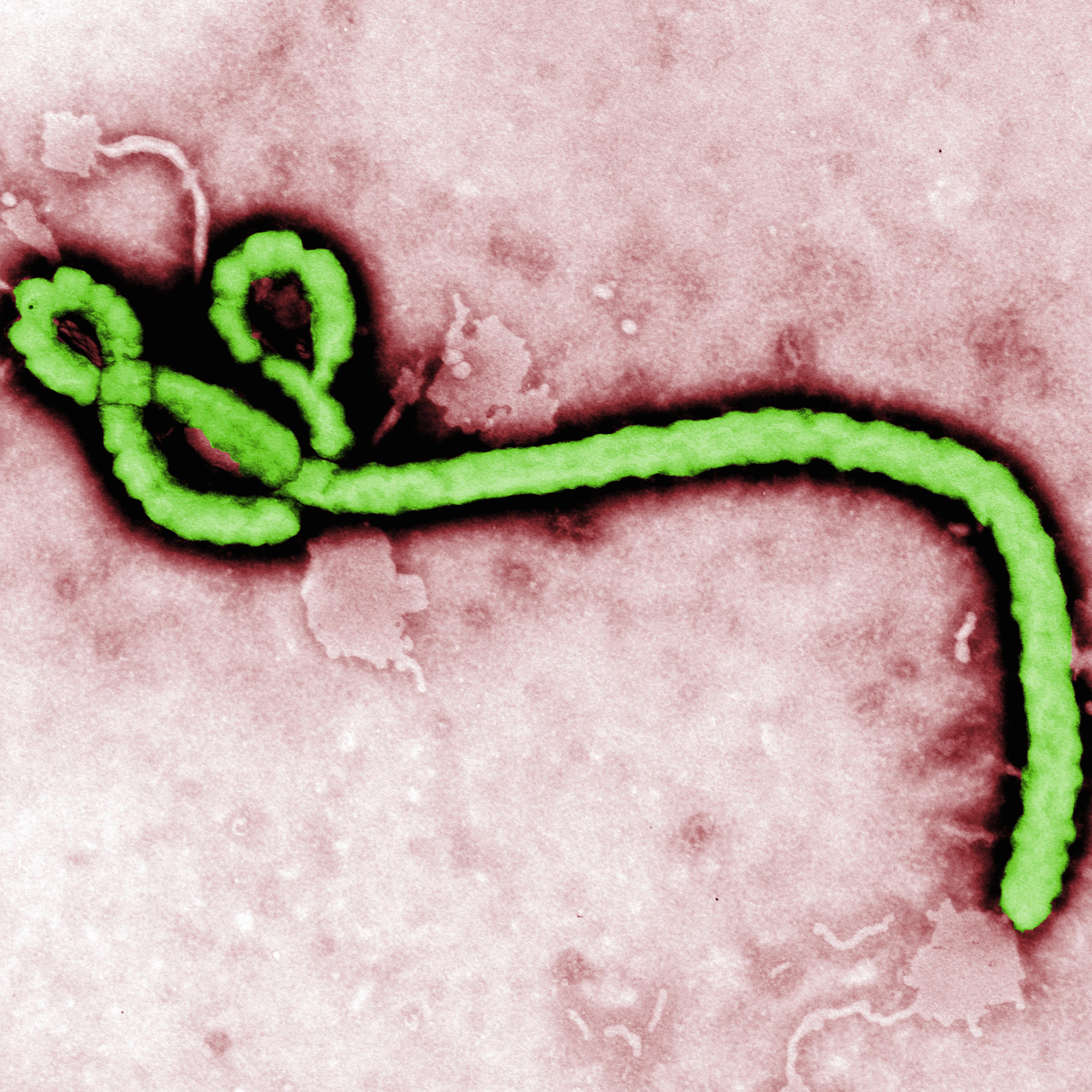Transmission electron micrograph (TEM) of an Ebola virus virion