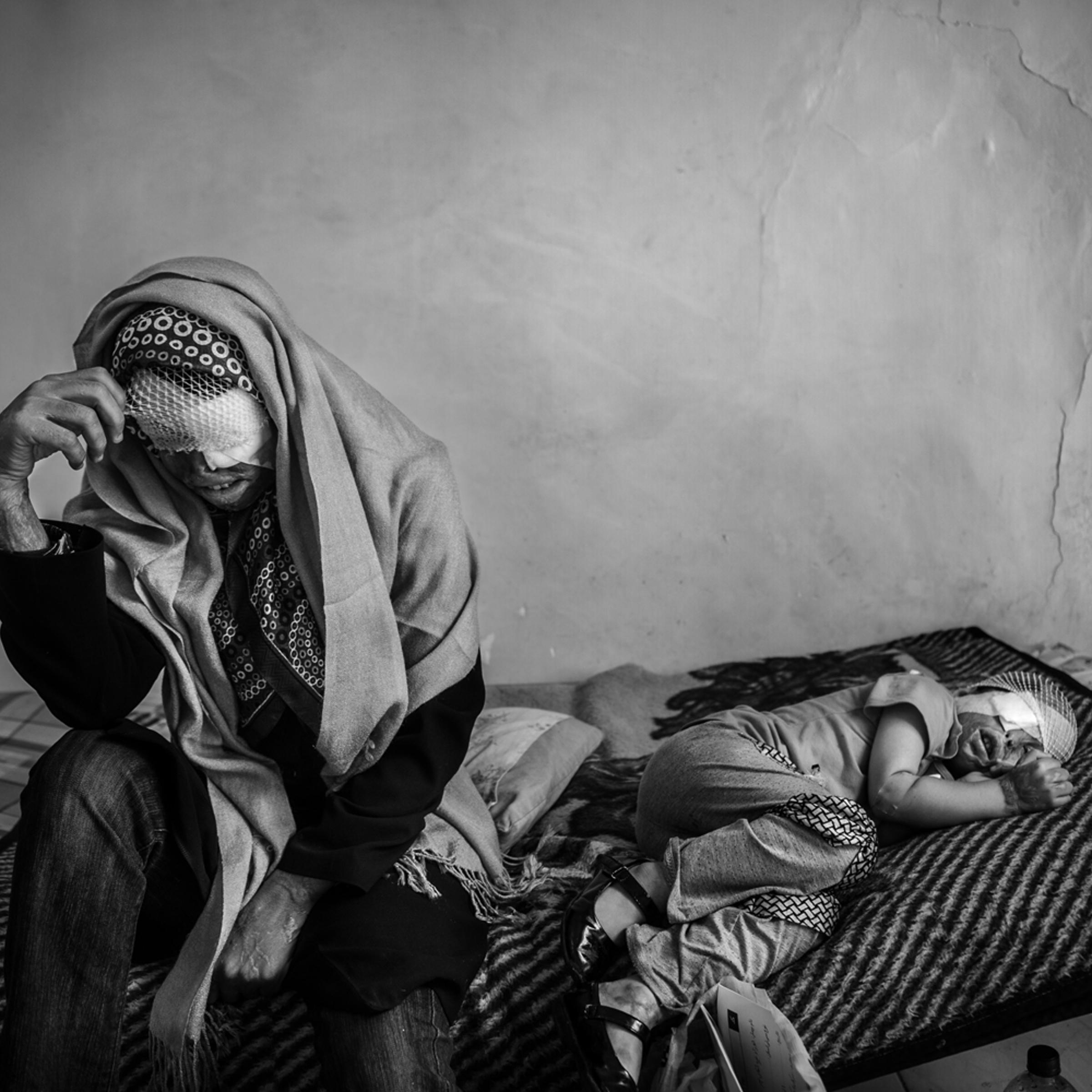 <em>The following photographs were taken between May and December of 2012.</em><br><br>Sommayeh and her daughter Rana rest in a hostel in downtown Tehran. The two have shuttled to the Iranian capital for treatment after Sommayeh's husband attacked the family with acid.