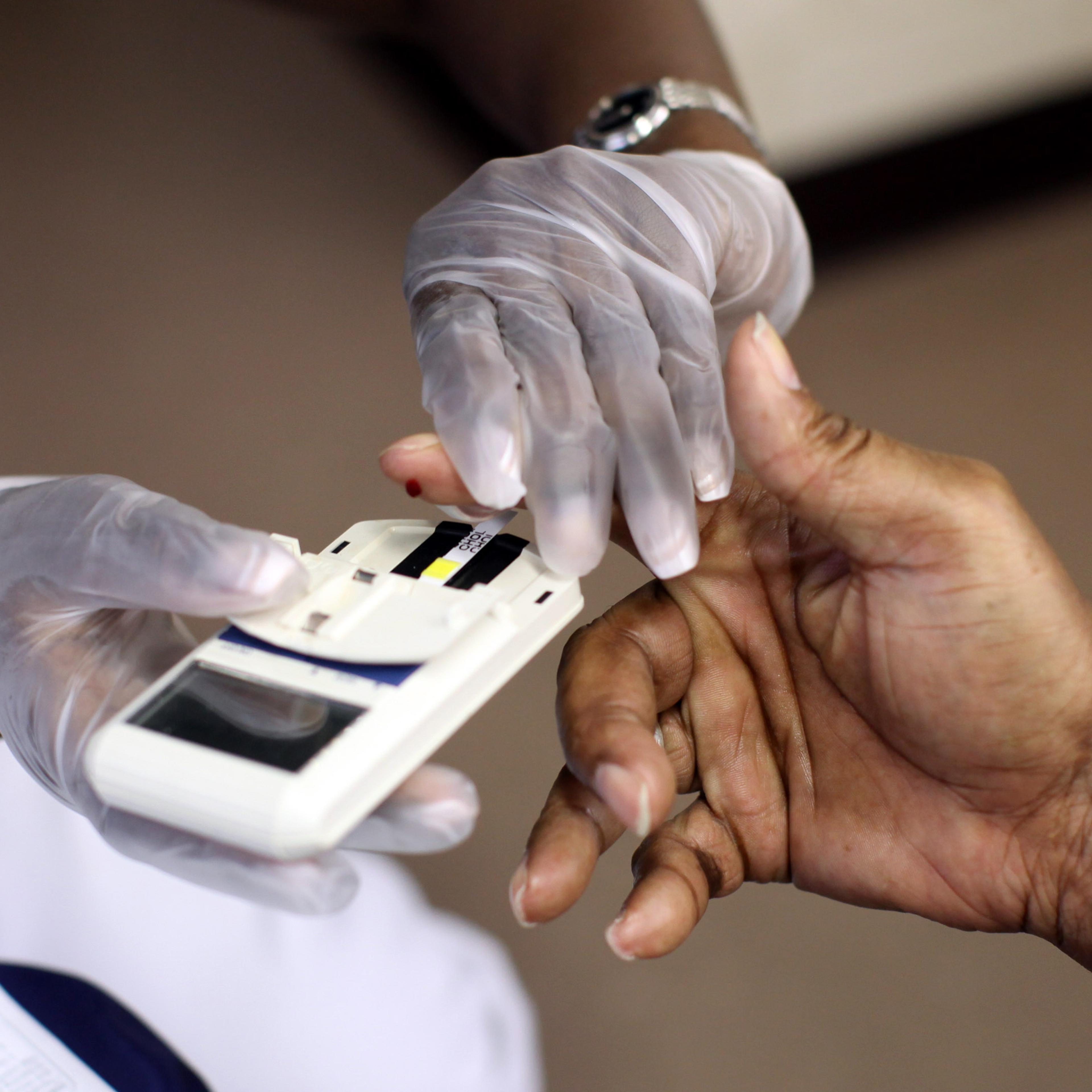cholesterol test