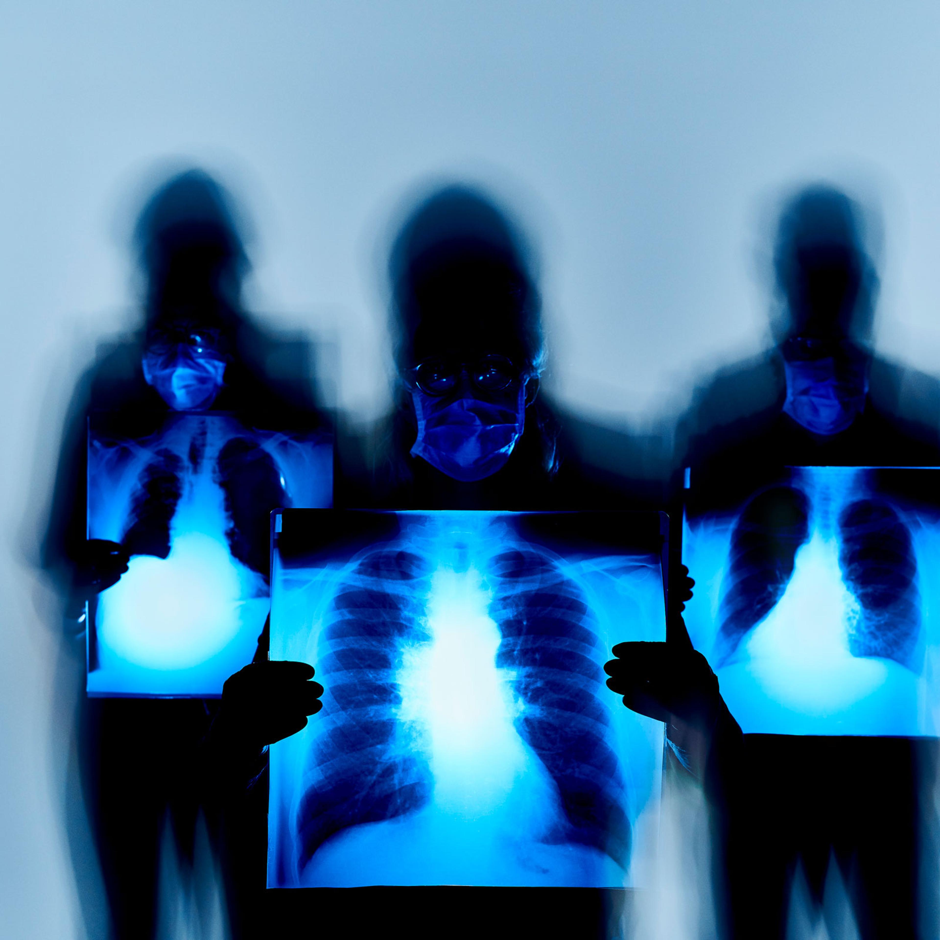functional-imaging-xray